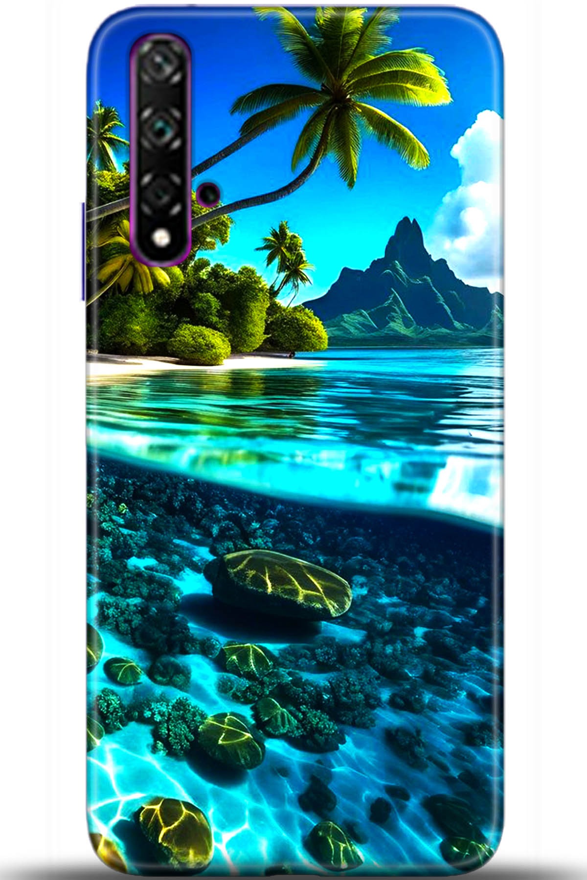 Honor 20 Kılıf HD Baskılı Kılıf - Followed Institution 5491