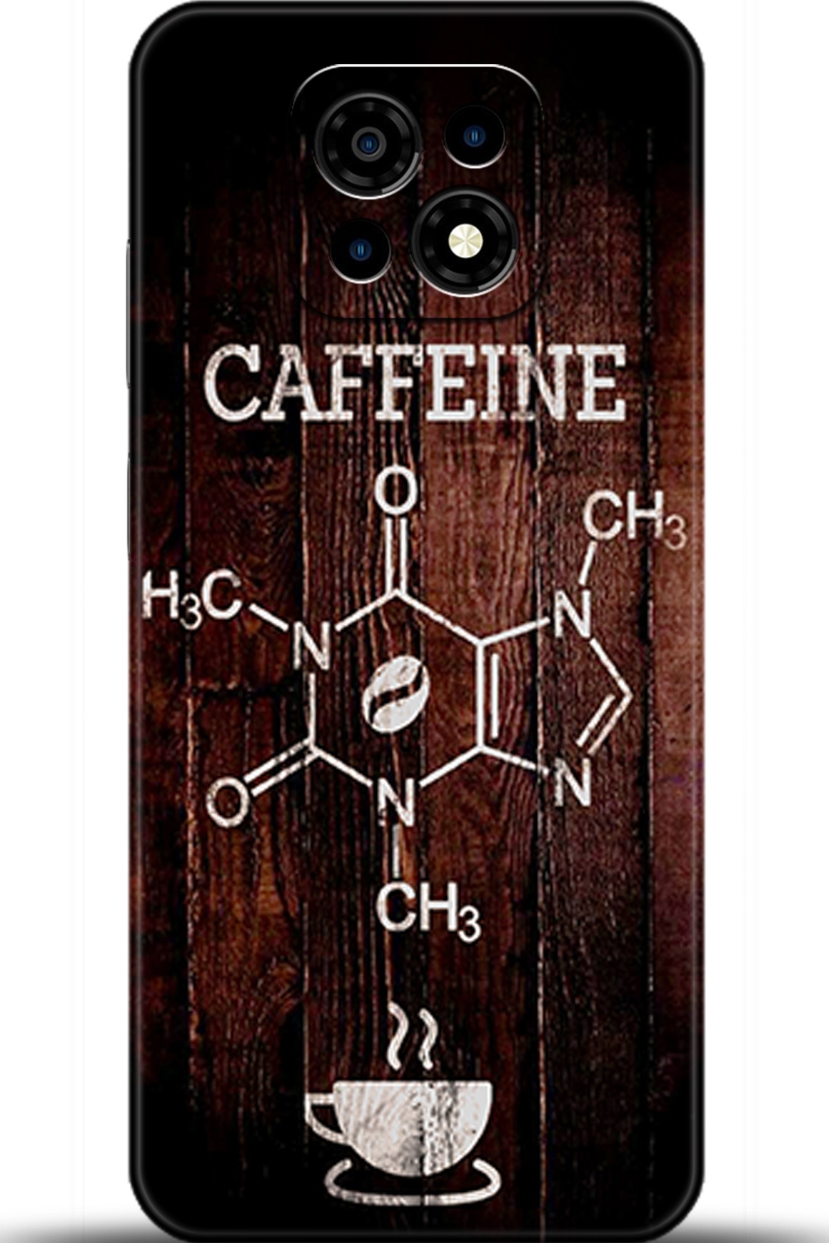 Casper Via M30 Uyumlu Kılıf HD Baskılı Kılıf - Followed Institution 5501