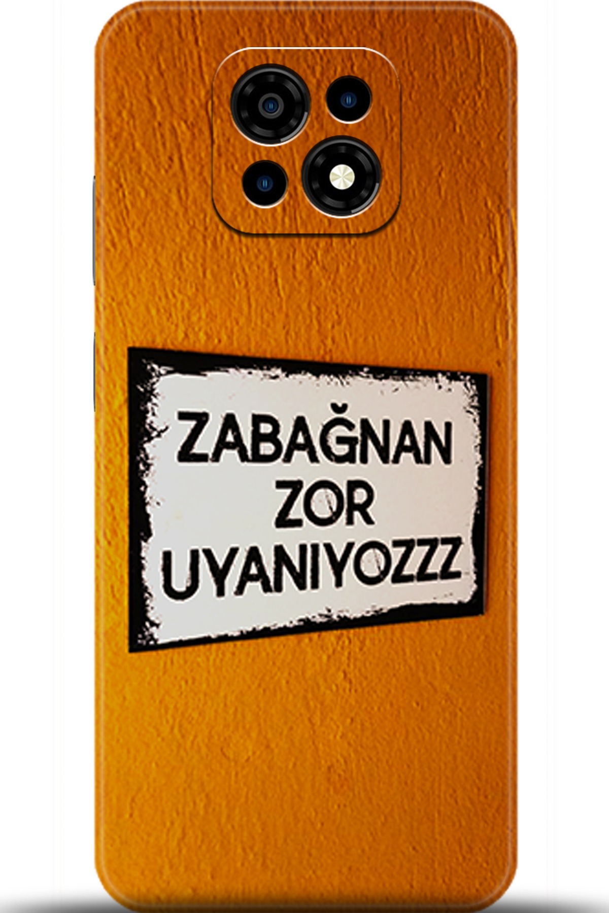 Casper Via M30 Uyumlu Kılıf HD Baskılı Kılıf - Followed Institution 5590