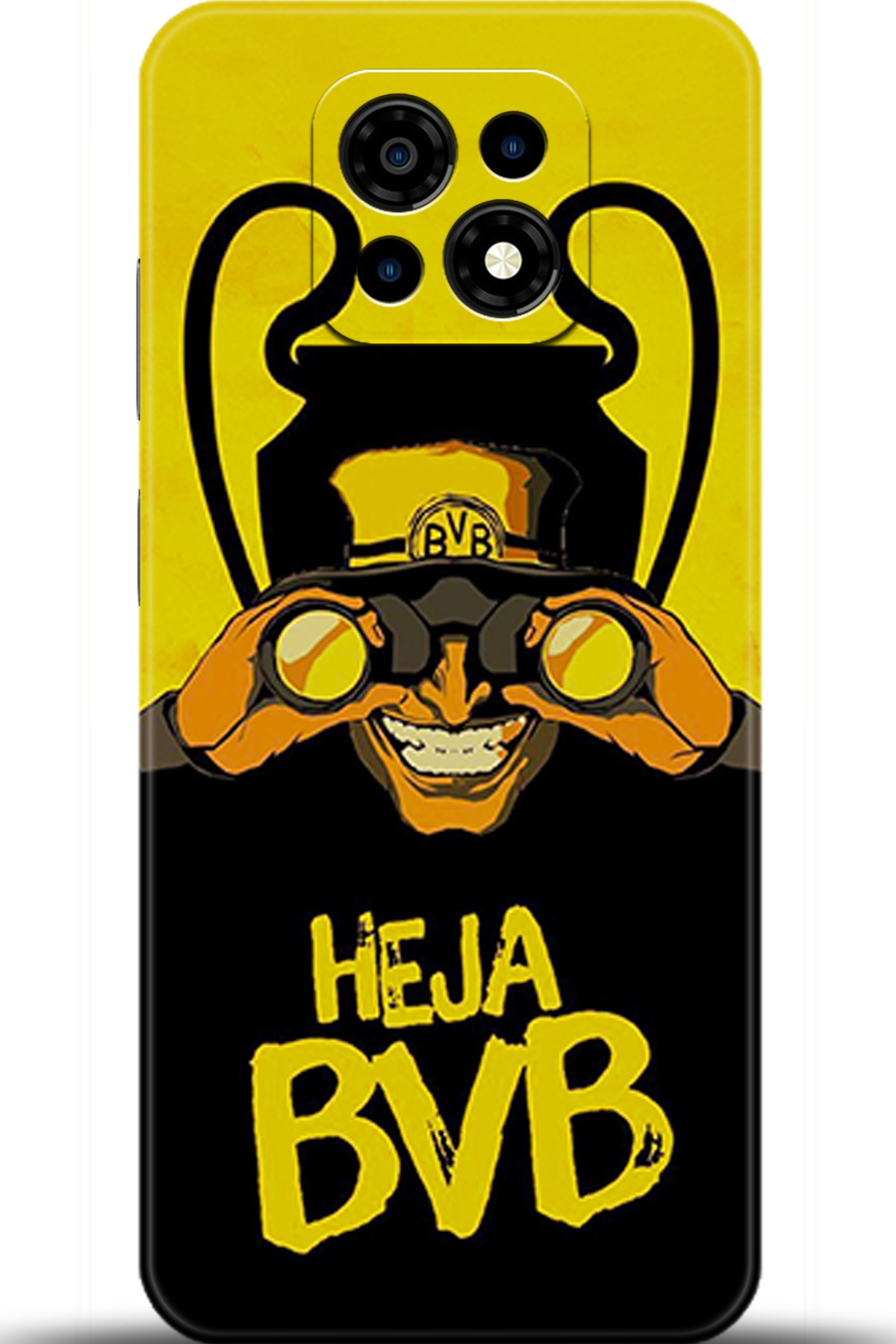 Casper Via M30 Uyumlu Kılıf HD Baskılı Kılıf - Followed Institution 5634