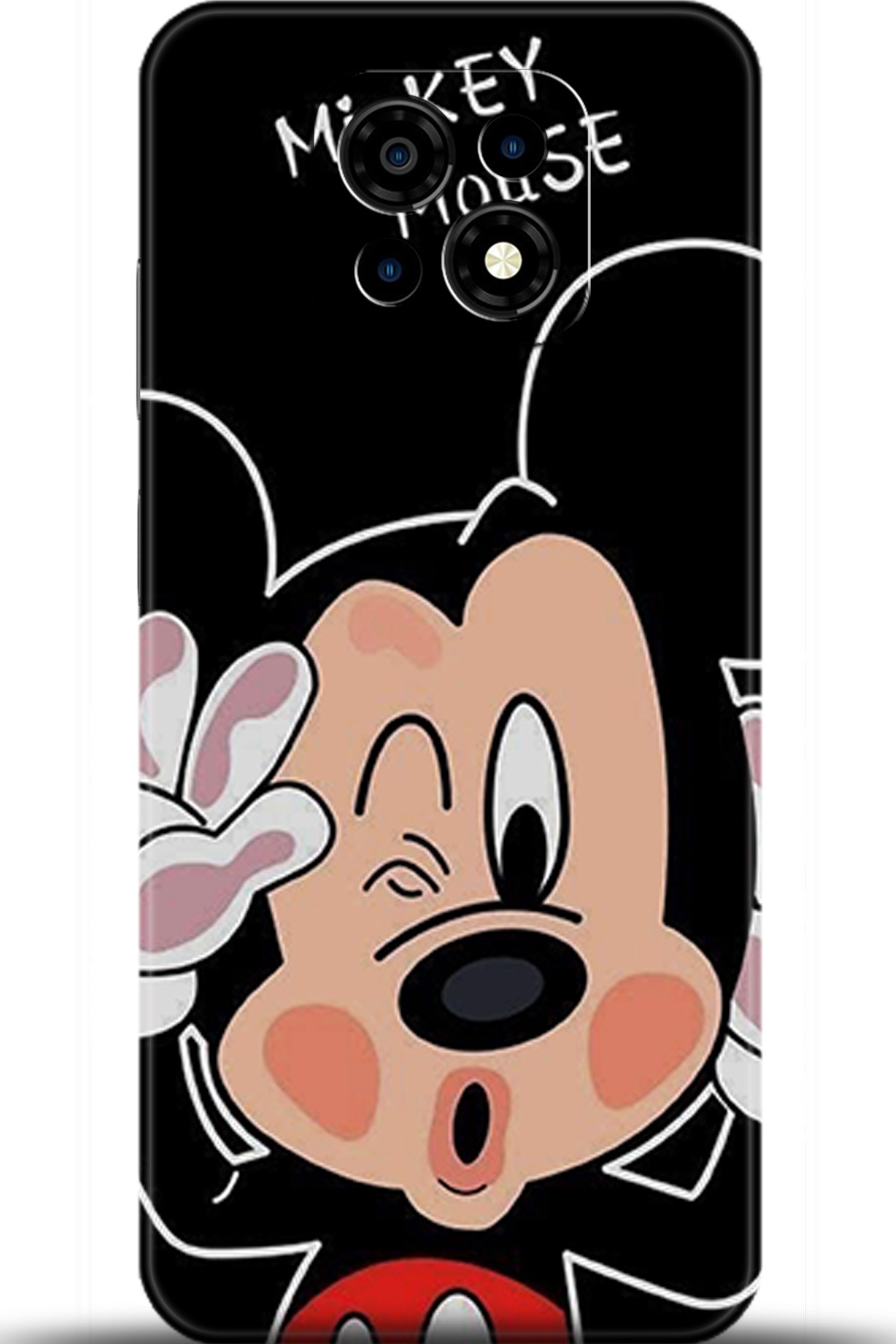 Casper Via M30 Uyumlu Kılıf HD Baskılı Kılıf - Followed Institution 5911