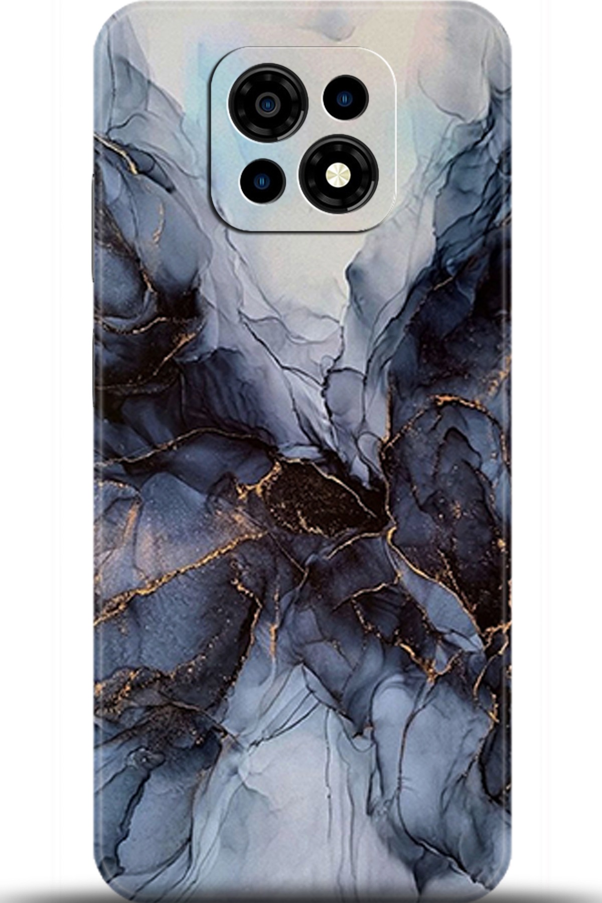 Casper Via M30 Uyumlu Kılıf HD Baskılı Kılıf - Followed Institution 5945