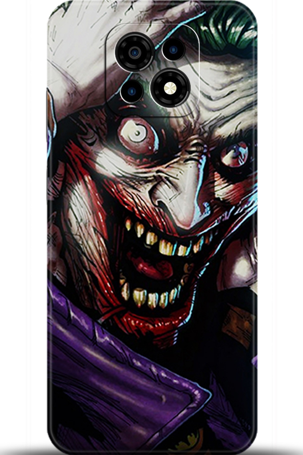 Casper Via M30 Uyumlu Kılıf HD Baskılı Kılıf - Followed Institution 5974