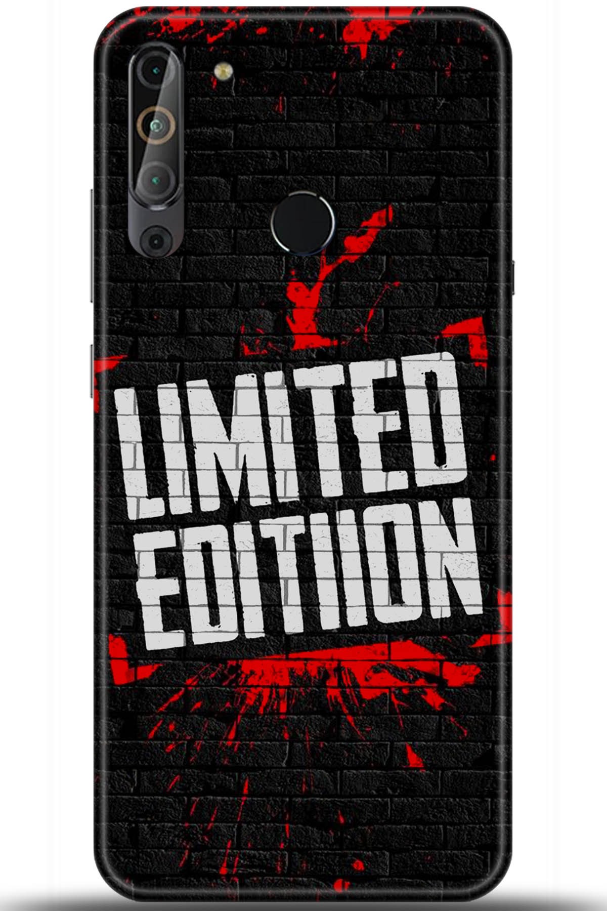 Casper Via X20 Uyumlu Kılıf HD Baskılı Kılıf - Followed Institution 5454