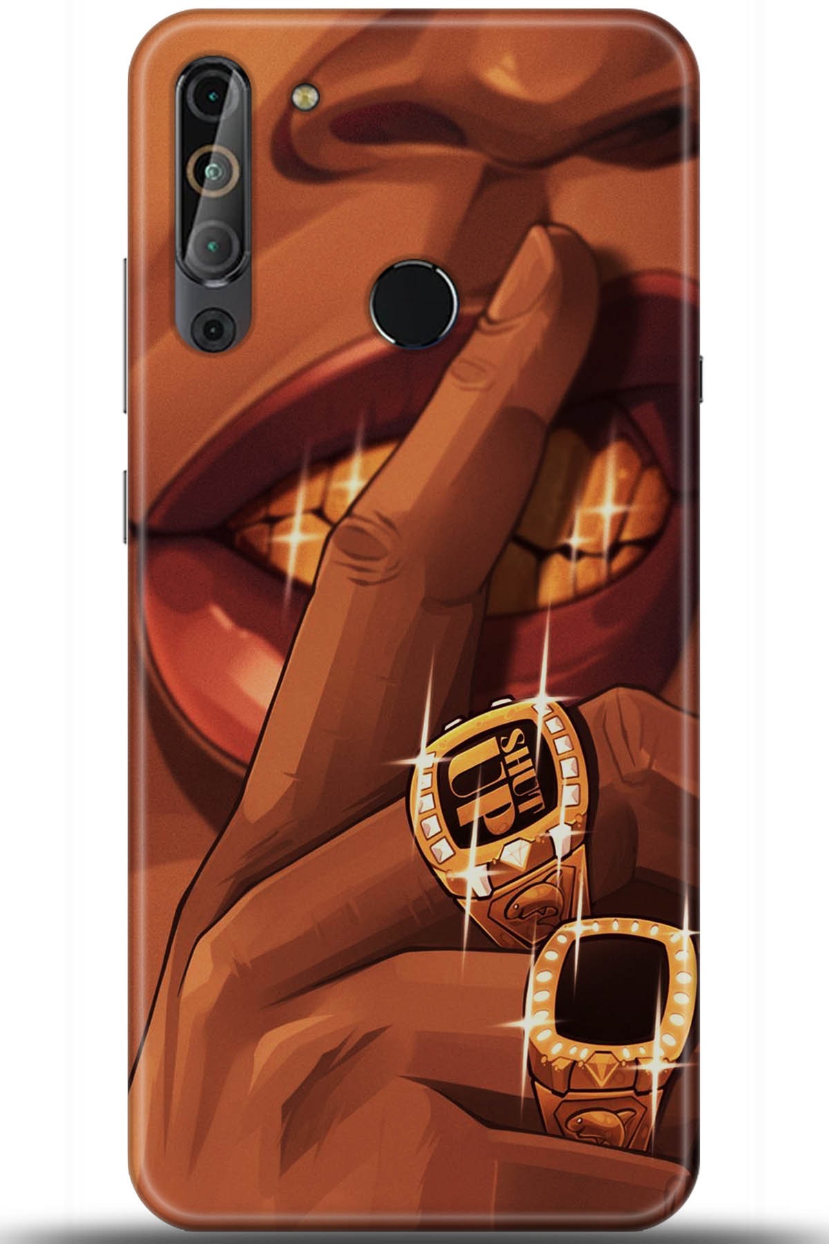 Casper Via X20 Uyumlu Kılıf HD Baskılı Kılıf - Followed Institution 5631