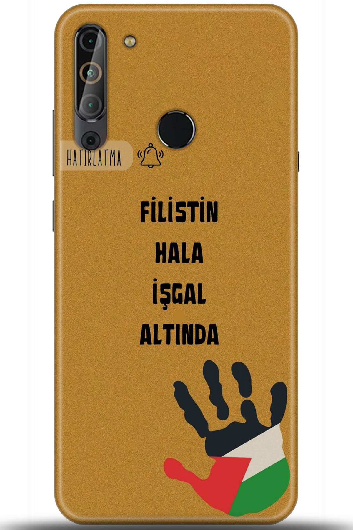 Casper Via X20 Uyumlu Kılıf HD Baskılı Kılıf - Followed Institution 5740