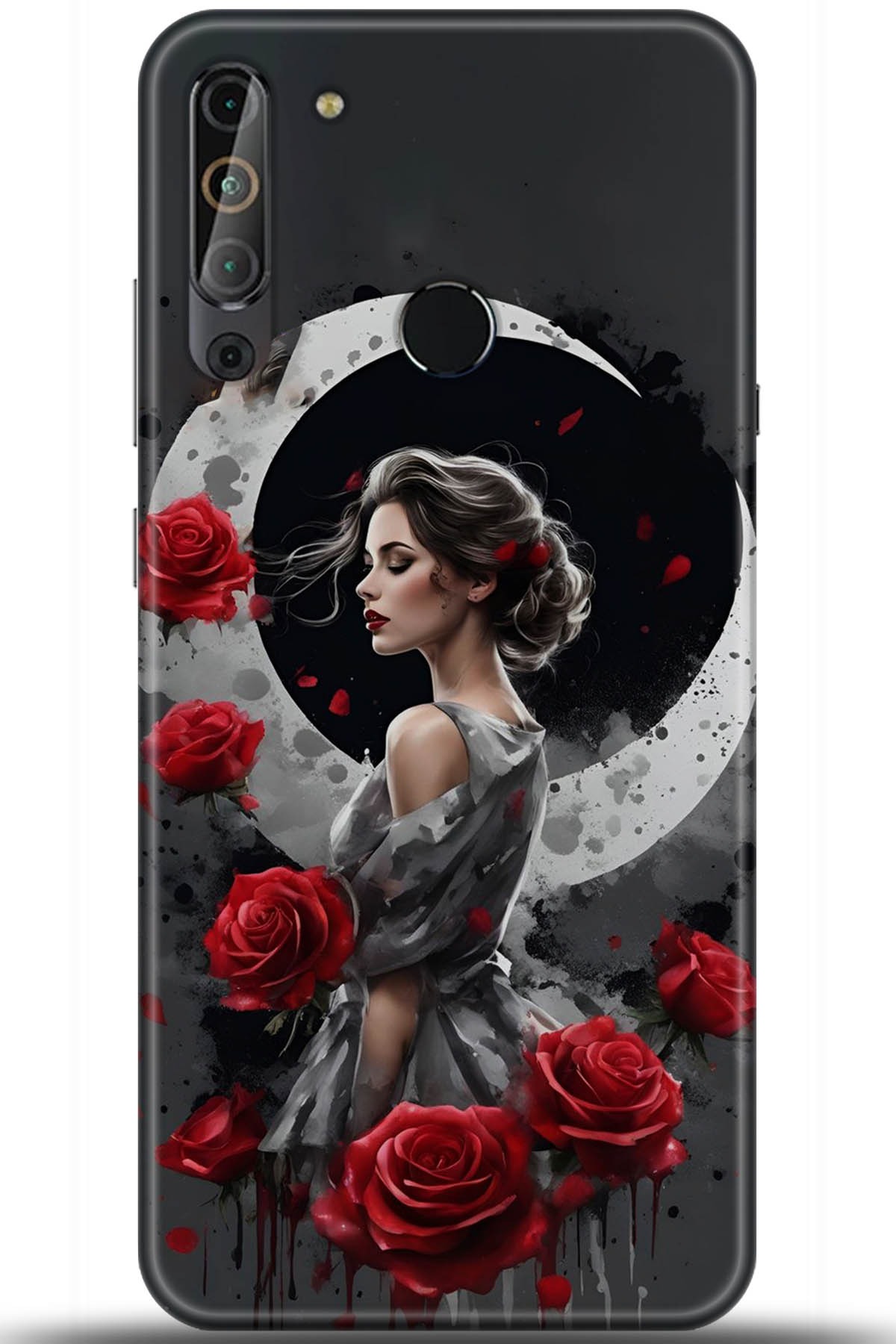 Casper Via X20 Uyumlu Kılıf HD Baskılı Kılıf - Followed Institution 5823