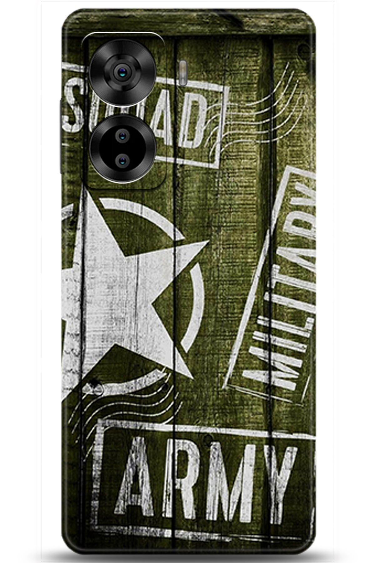 Casper Via X40 Uyumlu Kılıf HD Baskılı Kılıf - Followed Institution 5476