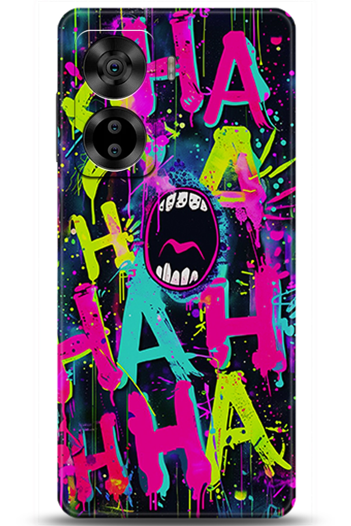 Casper Via X40 Uyumlu Kılıf HD Baskılı Kılıf - Followed Institution 5672