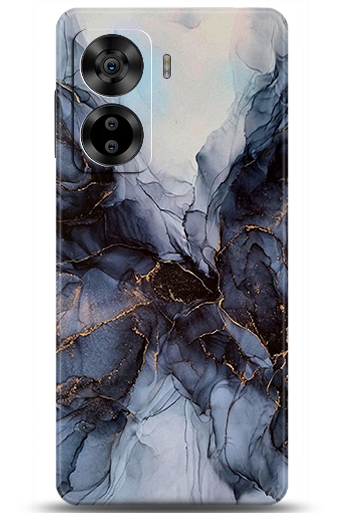 Casper Via X40 Uyumlu Kılıf HD Baskılı Kılıf - Followed Institution 5945