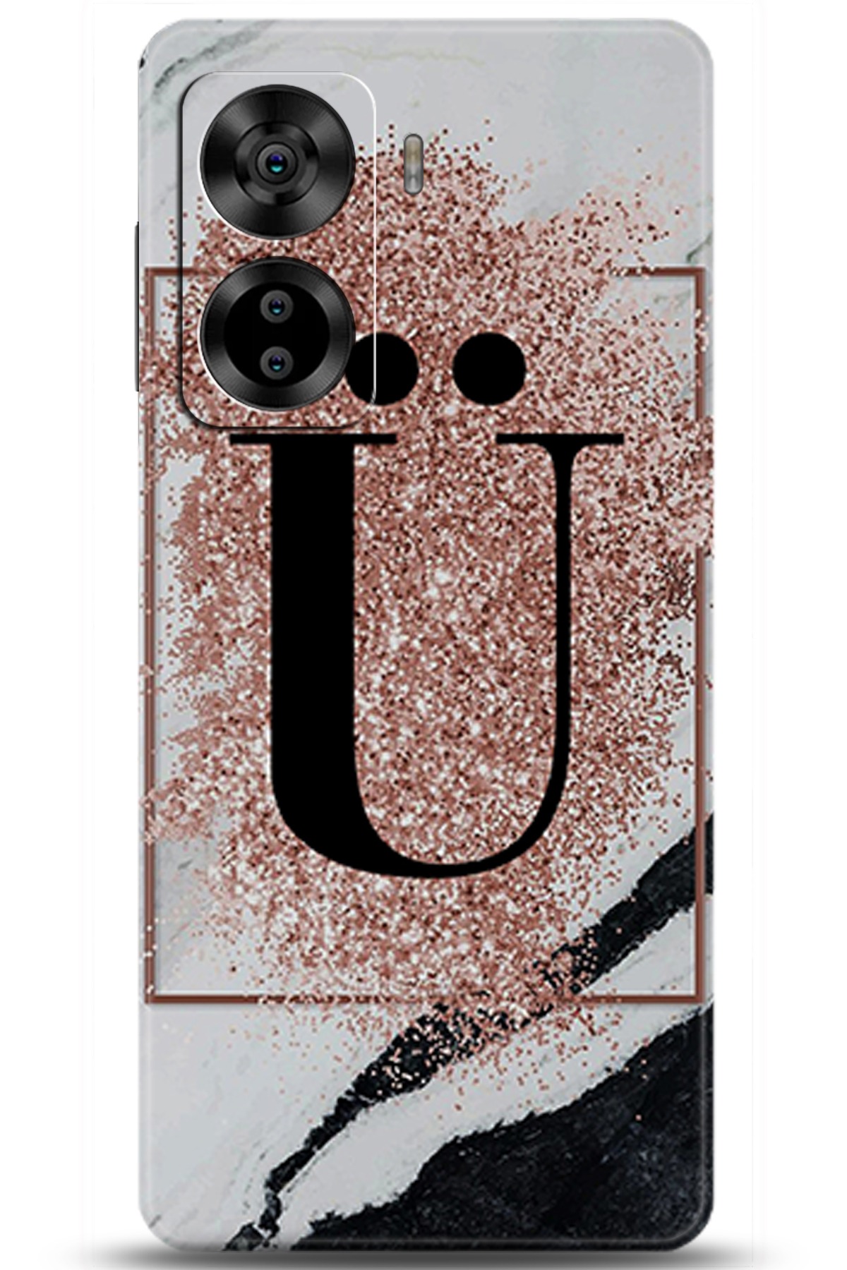 Casper Via X40 Uyumlu Kılıf HD Baskılı Kılıf - Followed Institution 5996