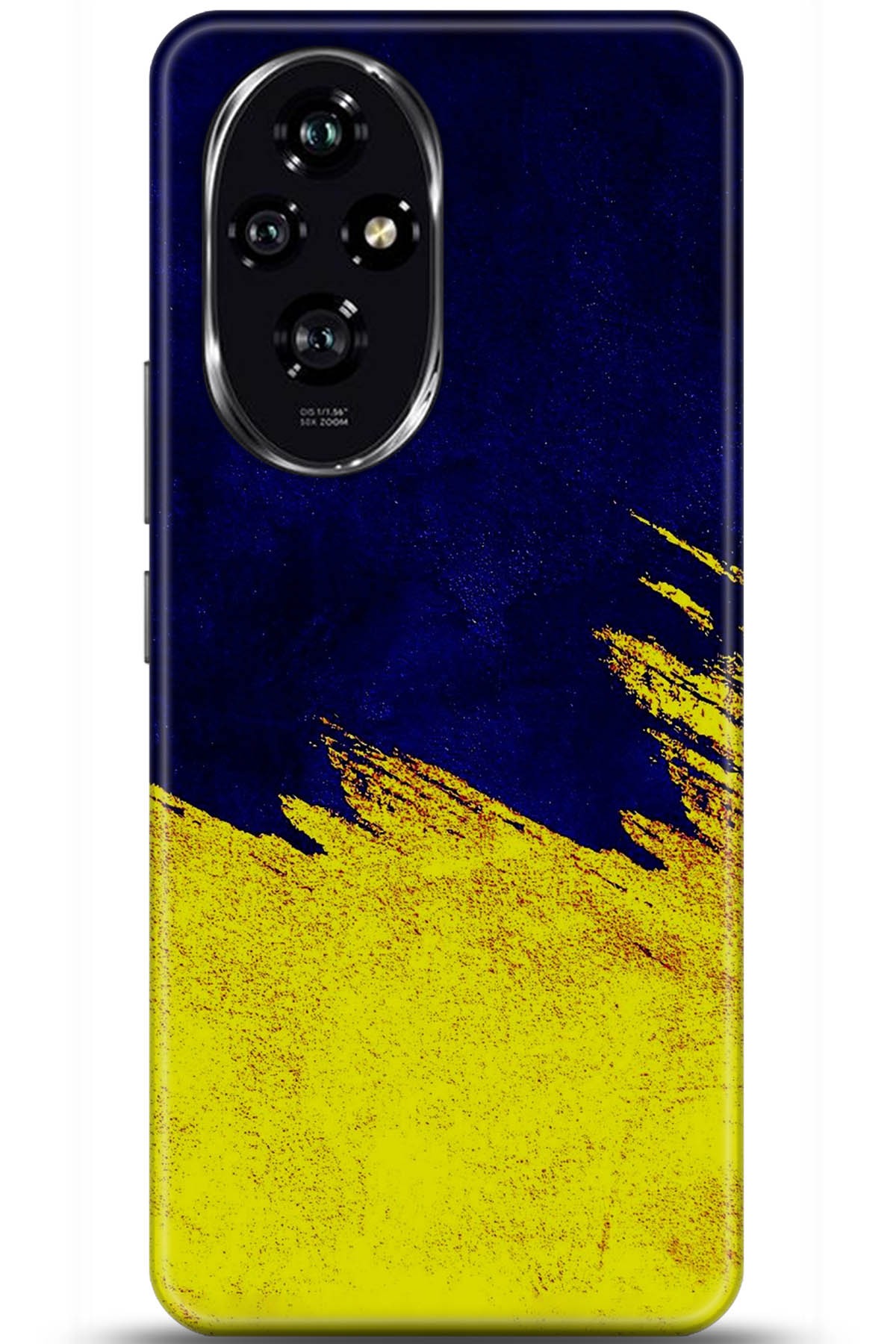 Honor 200 Uyumlu Kılıf HD Baskılı Kılıf - Followed Institution 5881