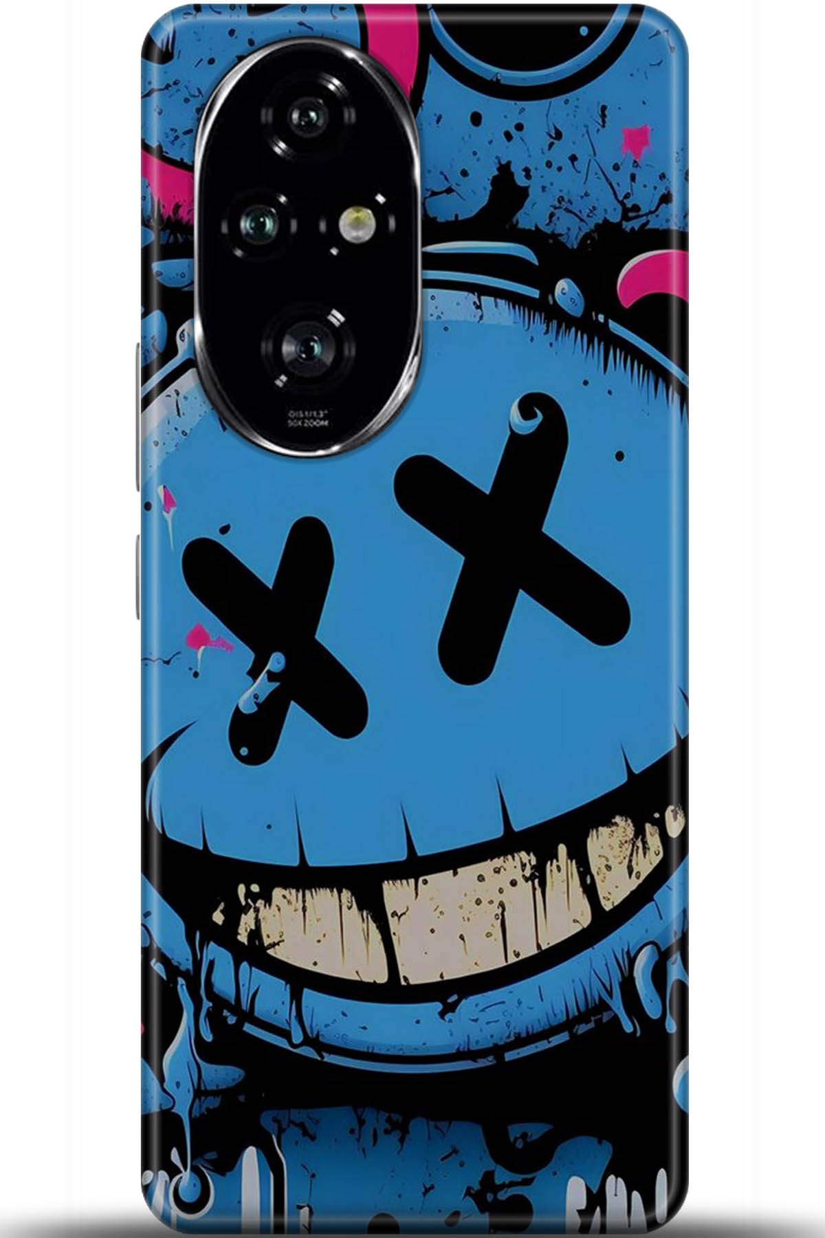 Honor 200 Pro Uyumlu Kılıf HD Baskılı Kılıf - Followed Institution 5261