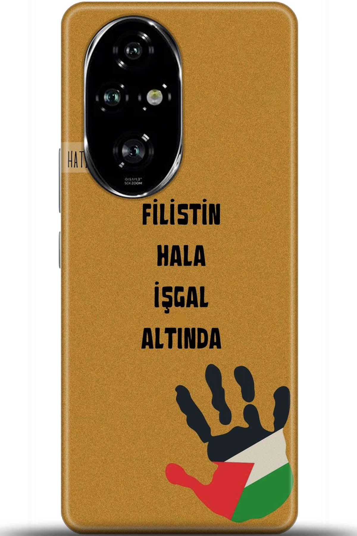 Honor 200 Pro Uyumlu Kılıf HD Baskılı Kılıf - Followed Institution 5740