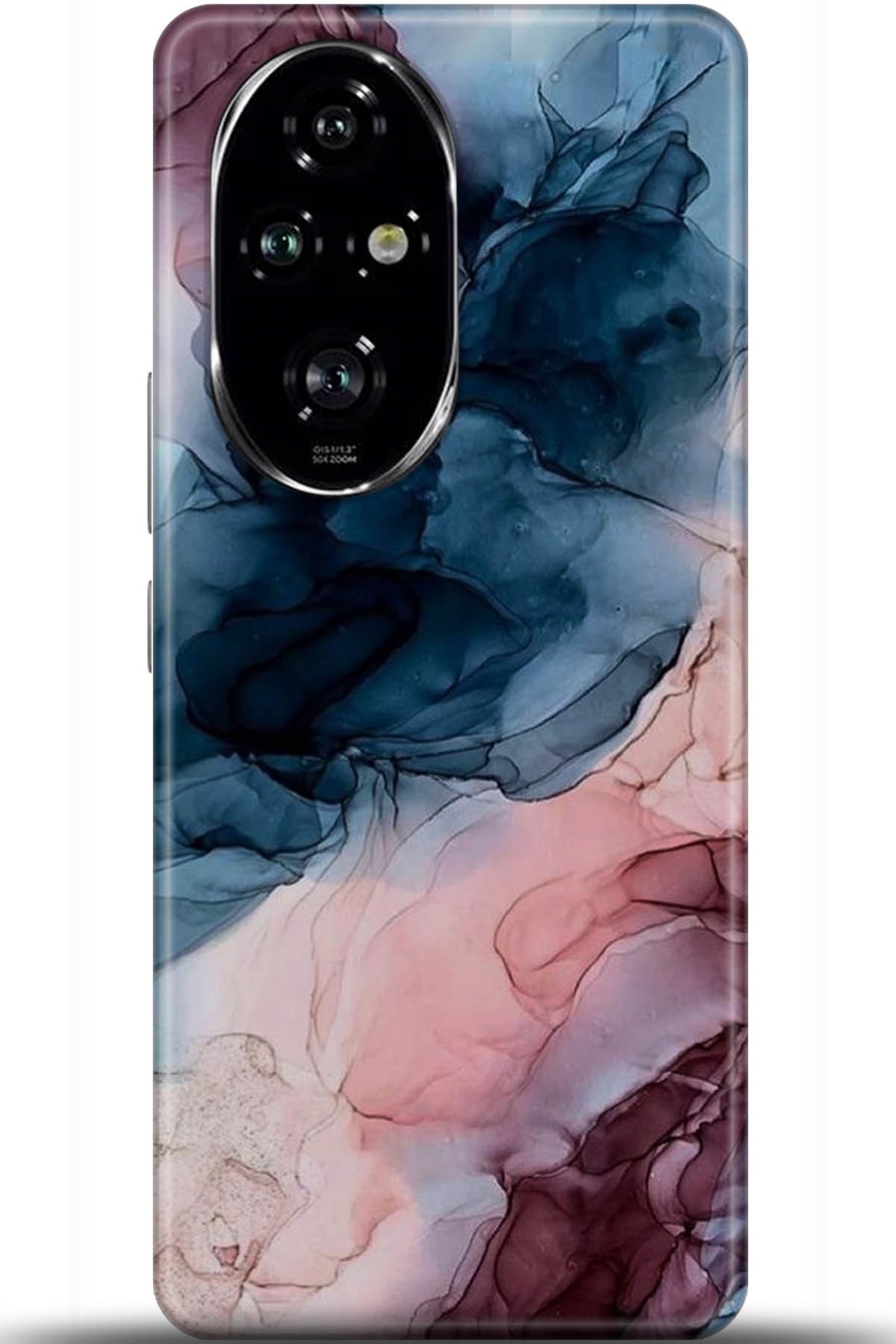 Honor 200 Pro Uyumlu Kılıf HD Baskılı Kılıf - Followed Institution 5985