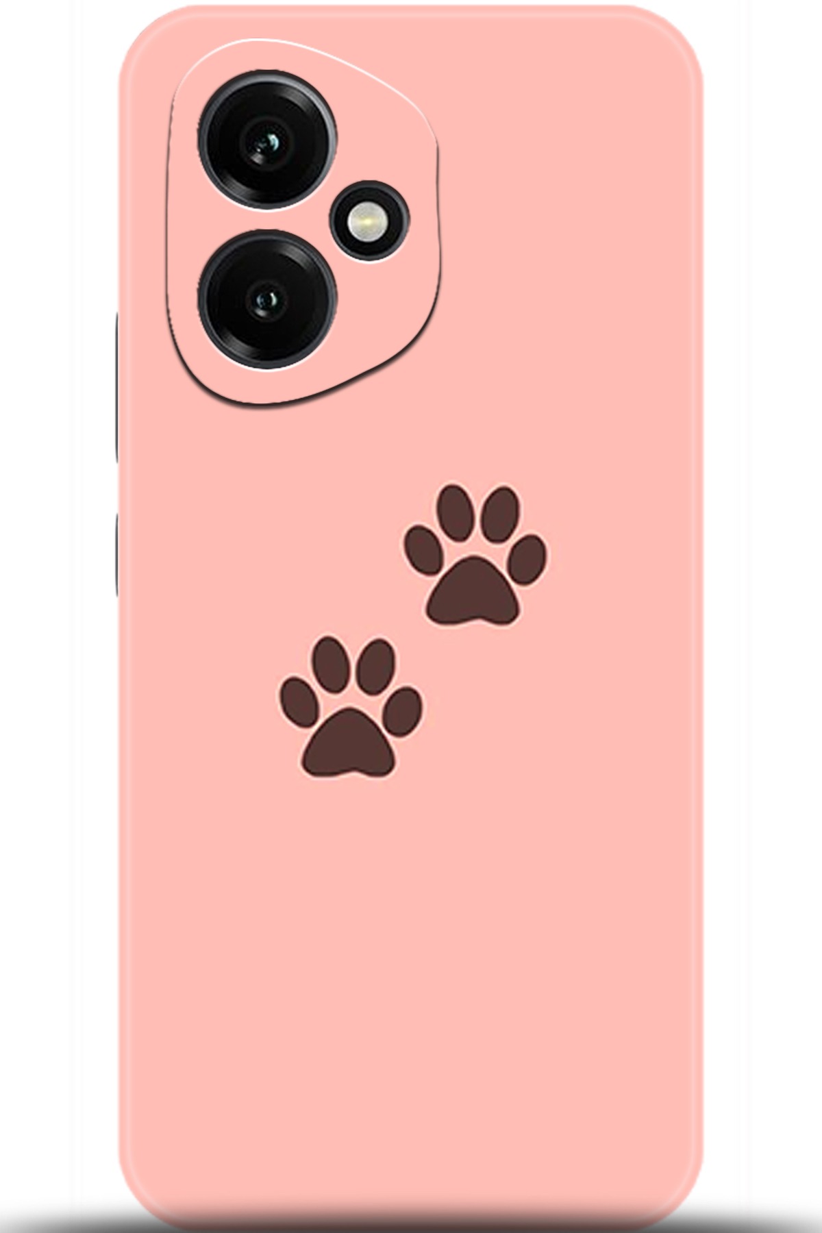 Honor 400 Uyumlu Kılıf HD Baskılı Kılıf - Followed Institution 5615