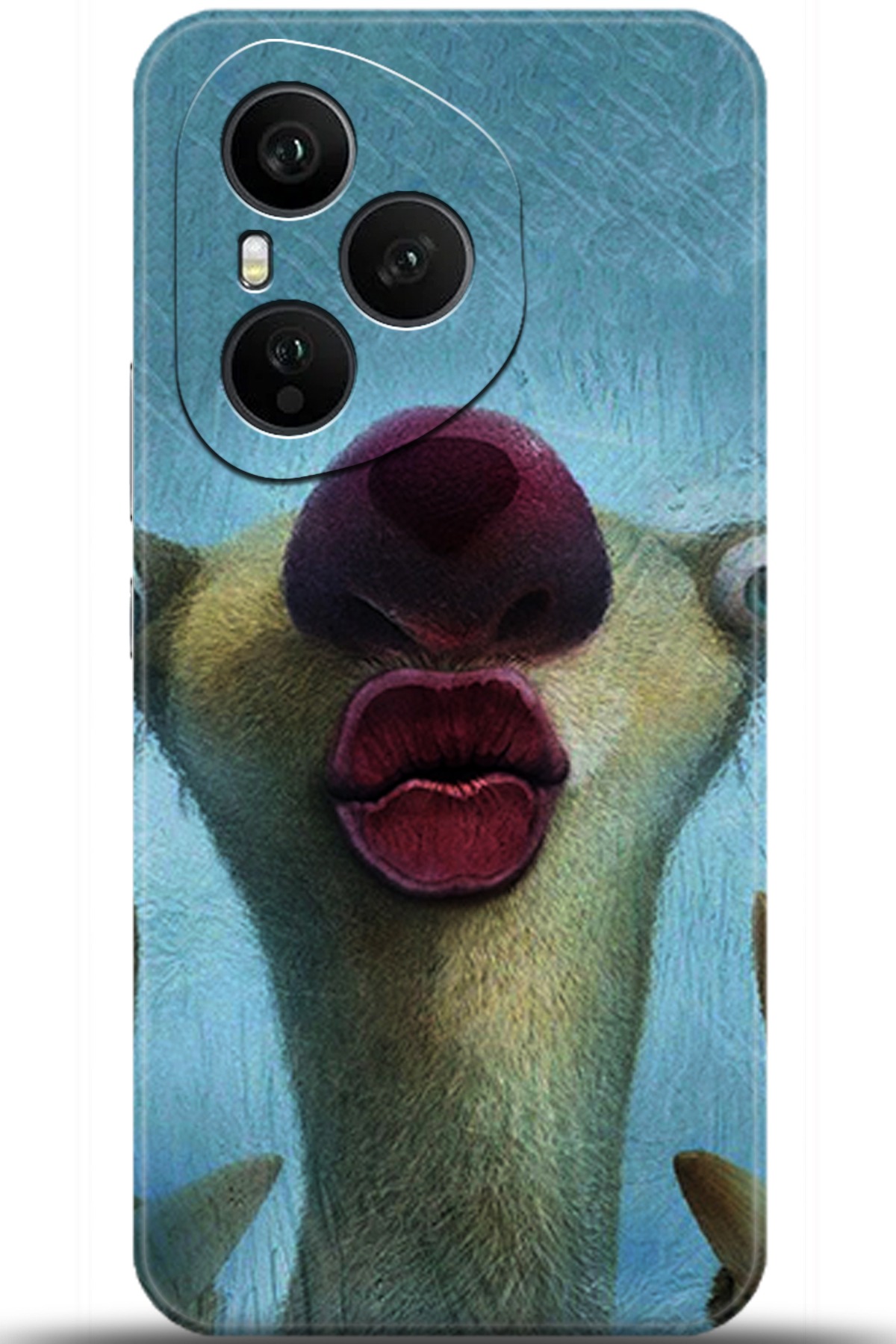 Honor 400 Pro Uyumlu Kılıf HD Baskılı Kılıf - Followed Institution 5372