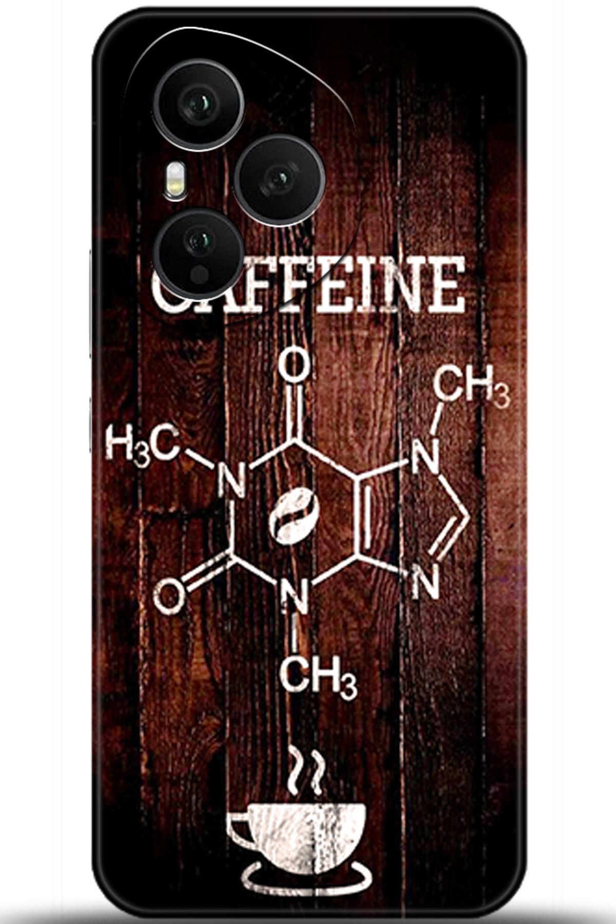 Honor 400 Pro Uyumlu Kılıf HD Baskılı Kılıf - Followed Institution 5501