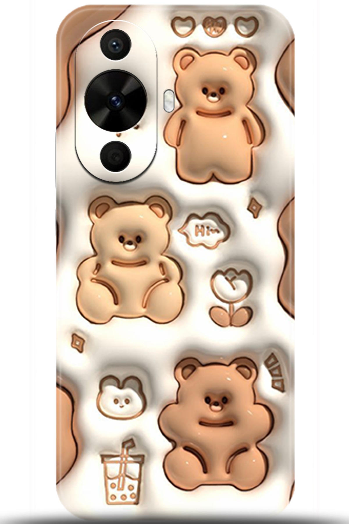 Huawei Nova 12s Uyumlu Kılıf HD Baskılı Kılıf - Followed Institution 5047