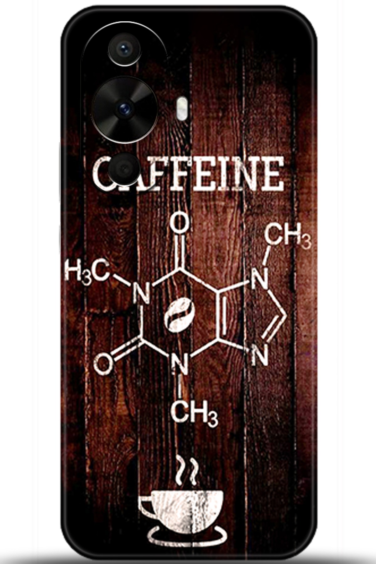 Huawei Nova 12s Uyumlu Kılıf HD Baskılı Kılıf - Followed Institution 5501