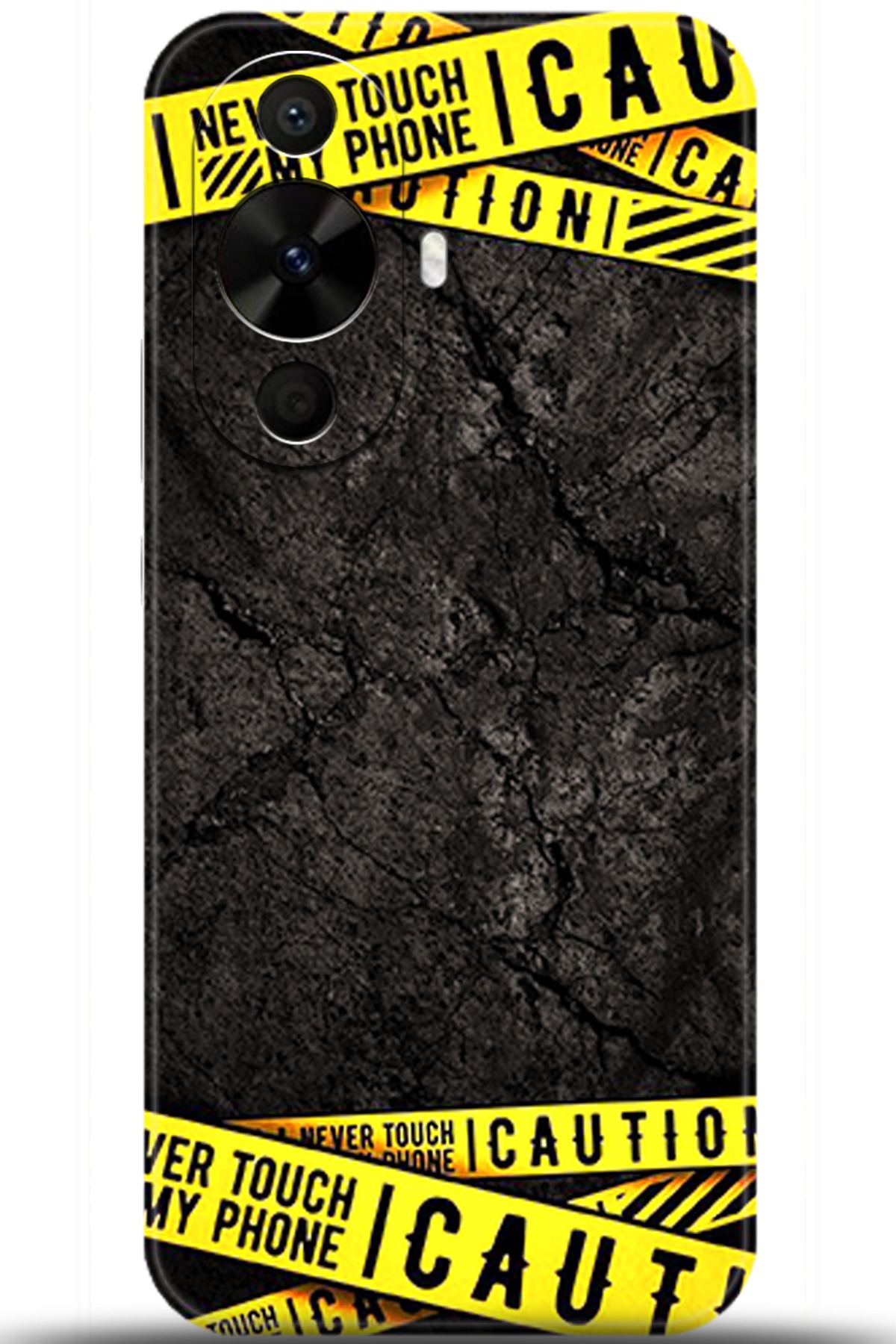 Huawei Nova 12s Uyumlu Kılıf HD Baskılı Kılıf - Followed Institution 5514