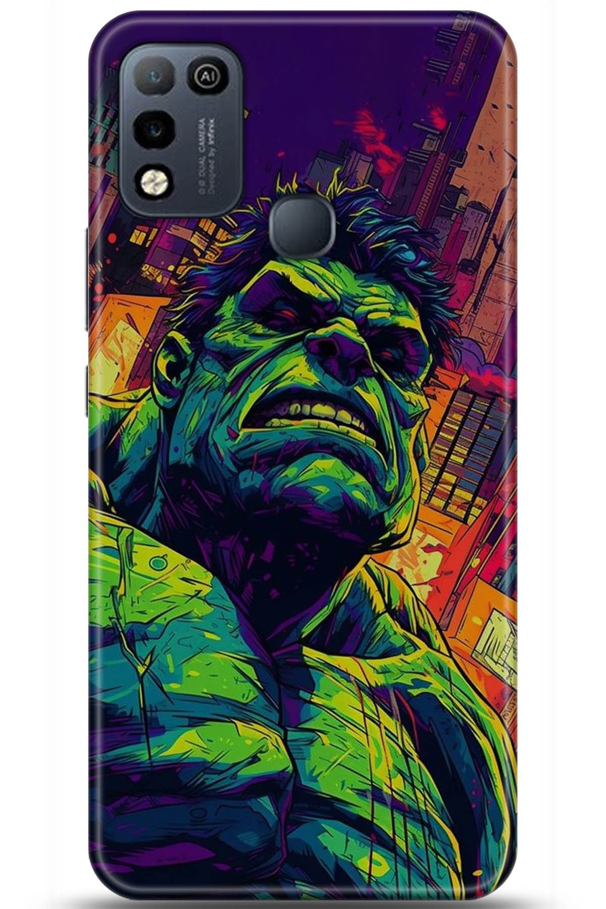 iNfinix Hot 10 Play Uyumlu Kılıf HD Baskılı Kılıf - Followed Institution 5365