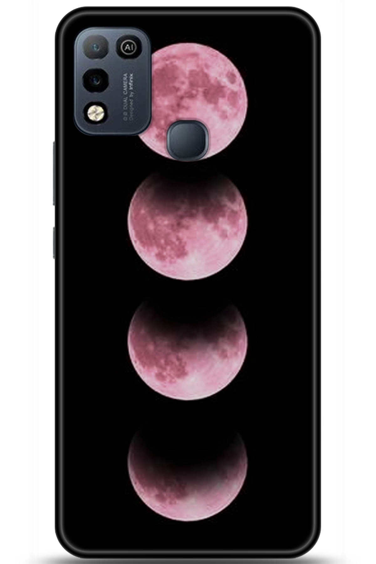 iNfinix Hot 10 Play Uyumlu Kılıf HD Baskılı Kılıf - Followed Institution 5915