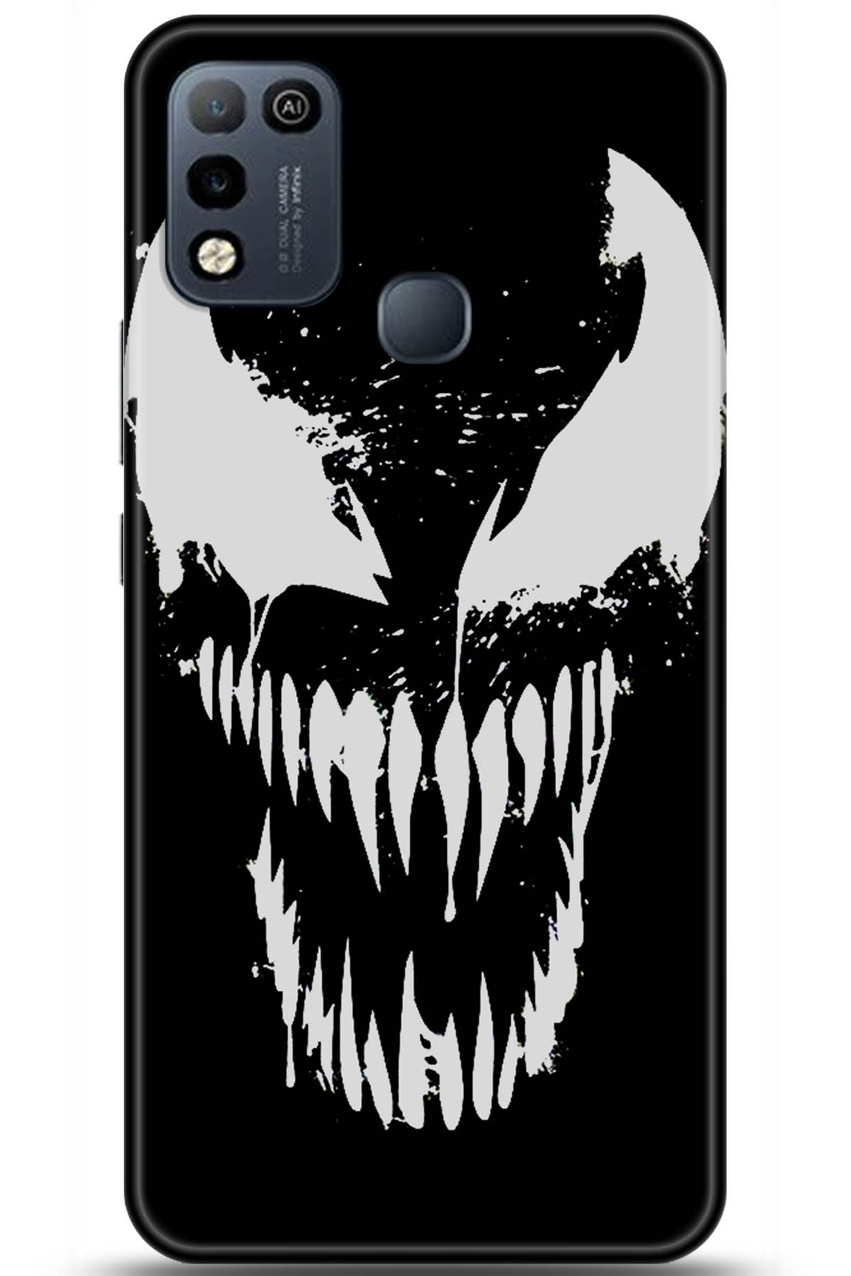 iNfinix Hot 10 Play Uyumlu Kılıf HD Baskılı Kılıf - Followed Institution 5939