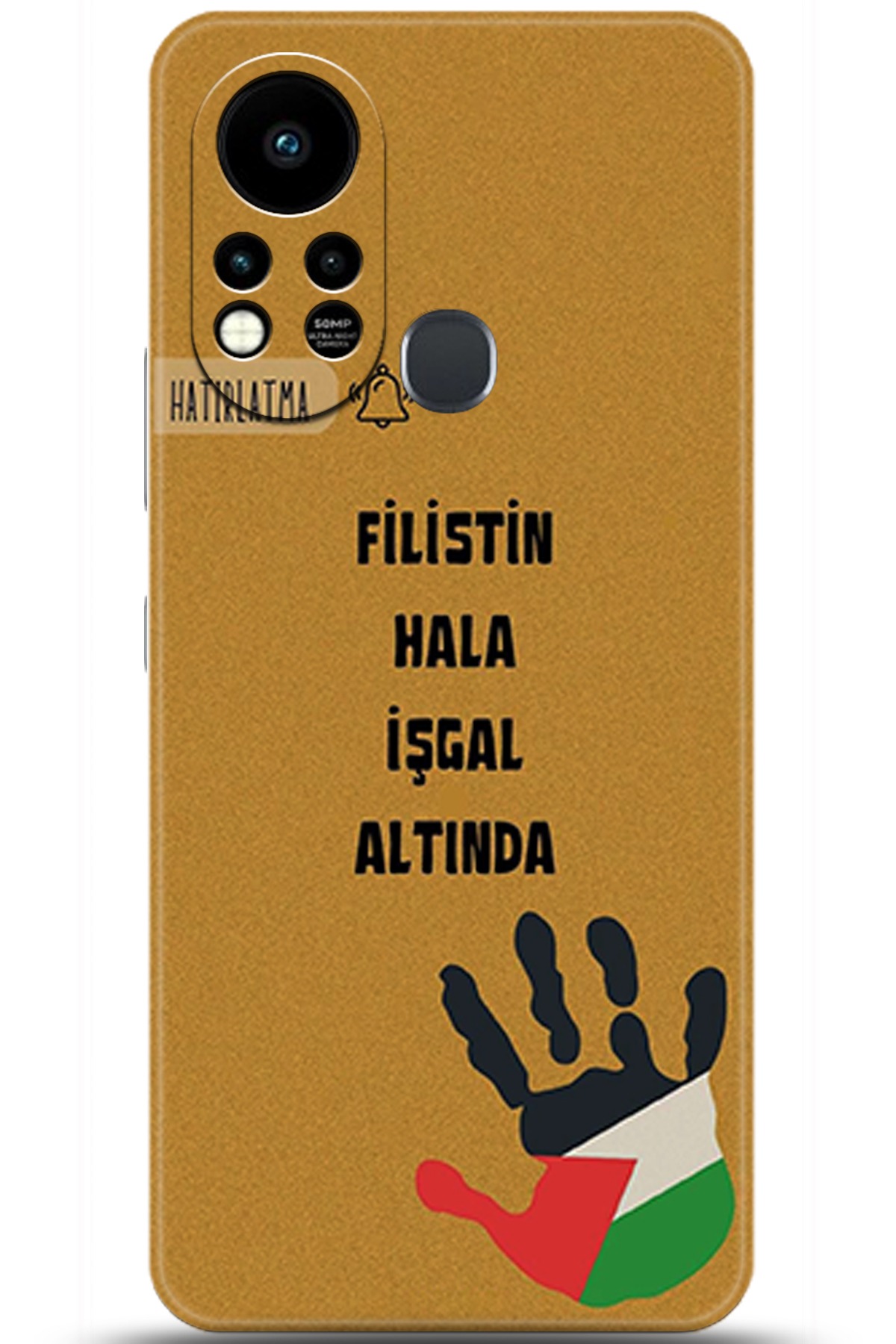 iNfinix Hot 11s Uyumlu Kılıf HD Baskılı Kılıf - Followed Institution 5740