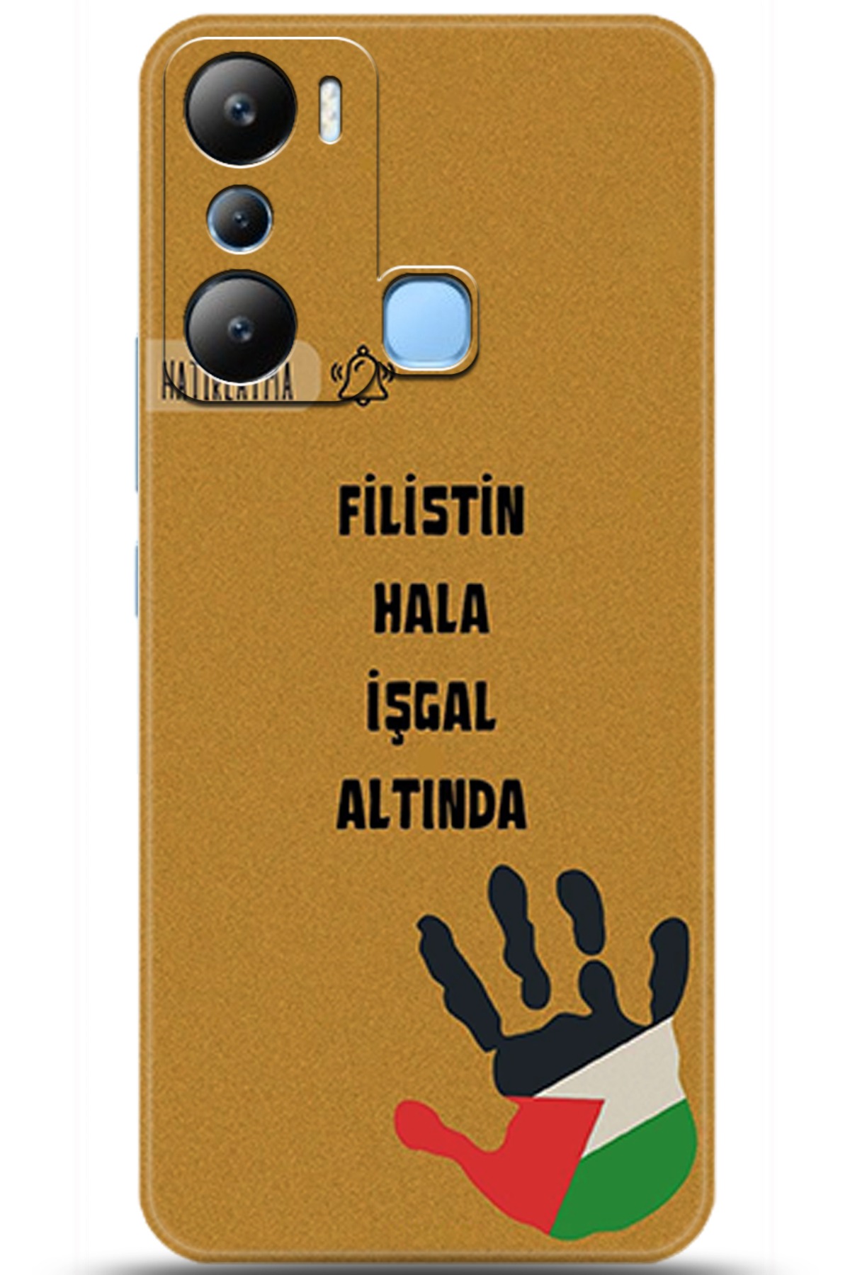 iNfinix Hot 20i Uyumlu Kılıf HD Baskılı Kılıf - Followed Institution 5740