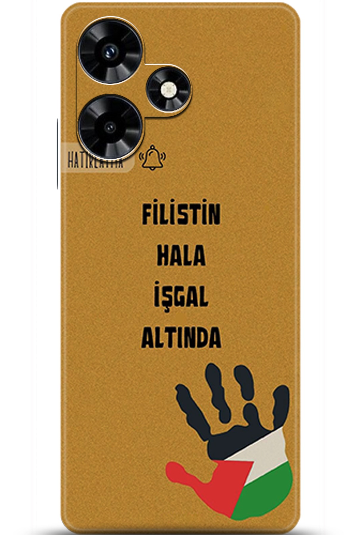 iNfinix Hot 30 Uyumlu Kılıf HD Baskılı Kılıf - Followed Institution 5740