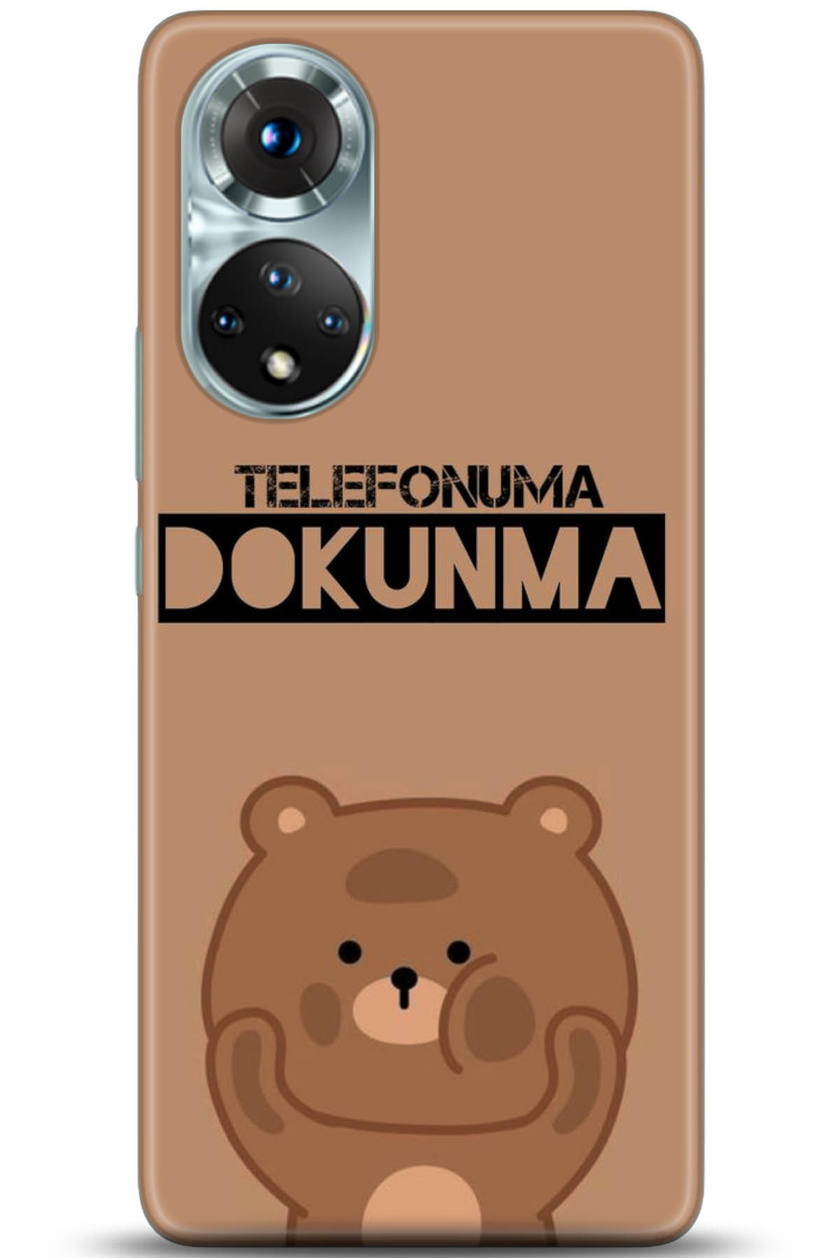 Honor 50 Kılıf HD Baskılı Kılıf - Followed Institution 5123