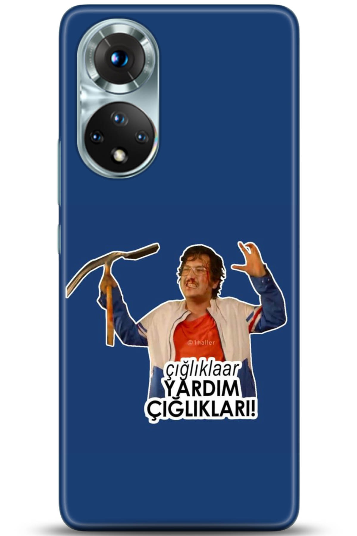 Honor 50 Kılıf HD Baskılı Kılıf - Followed Institution 5157