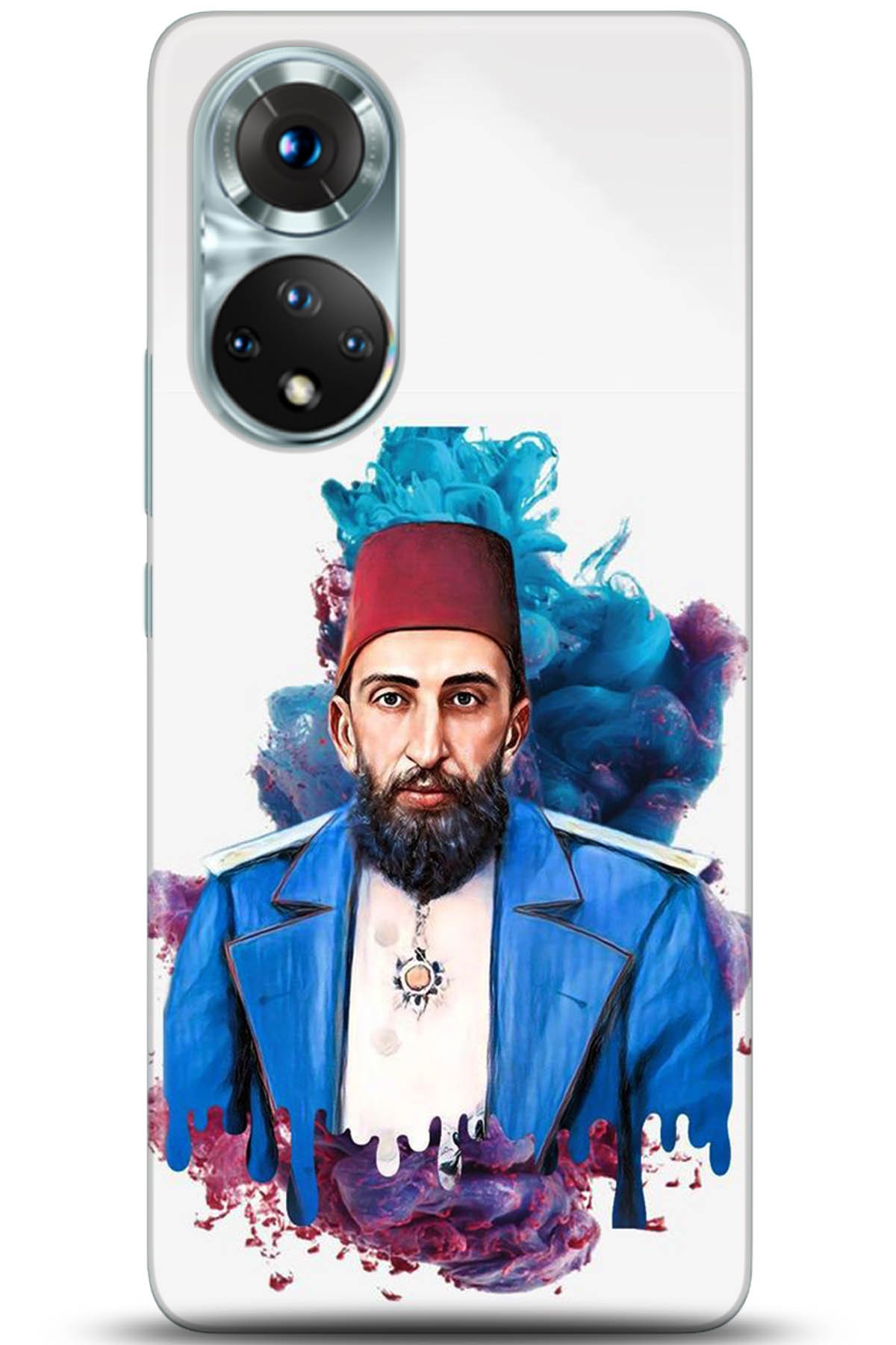 Honor 50 Kılıf HD Baskılı Kılıf - Followed Institution 5201