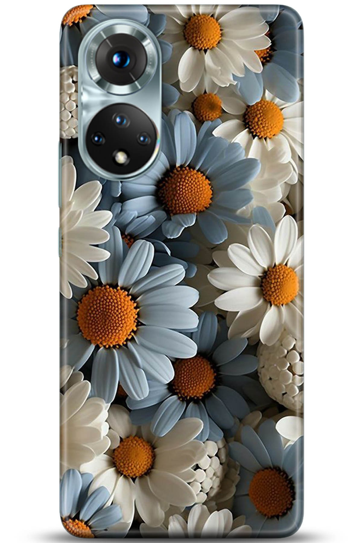 Honor 50 Kılıf HD Baskılı Kılıf - Followed Institution 5208