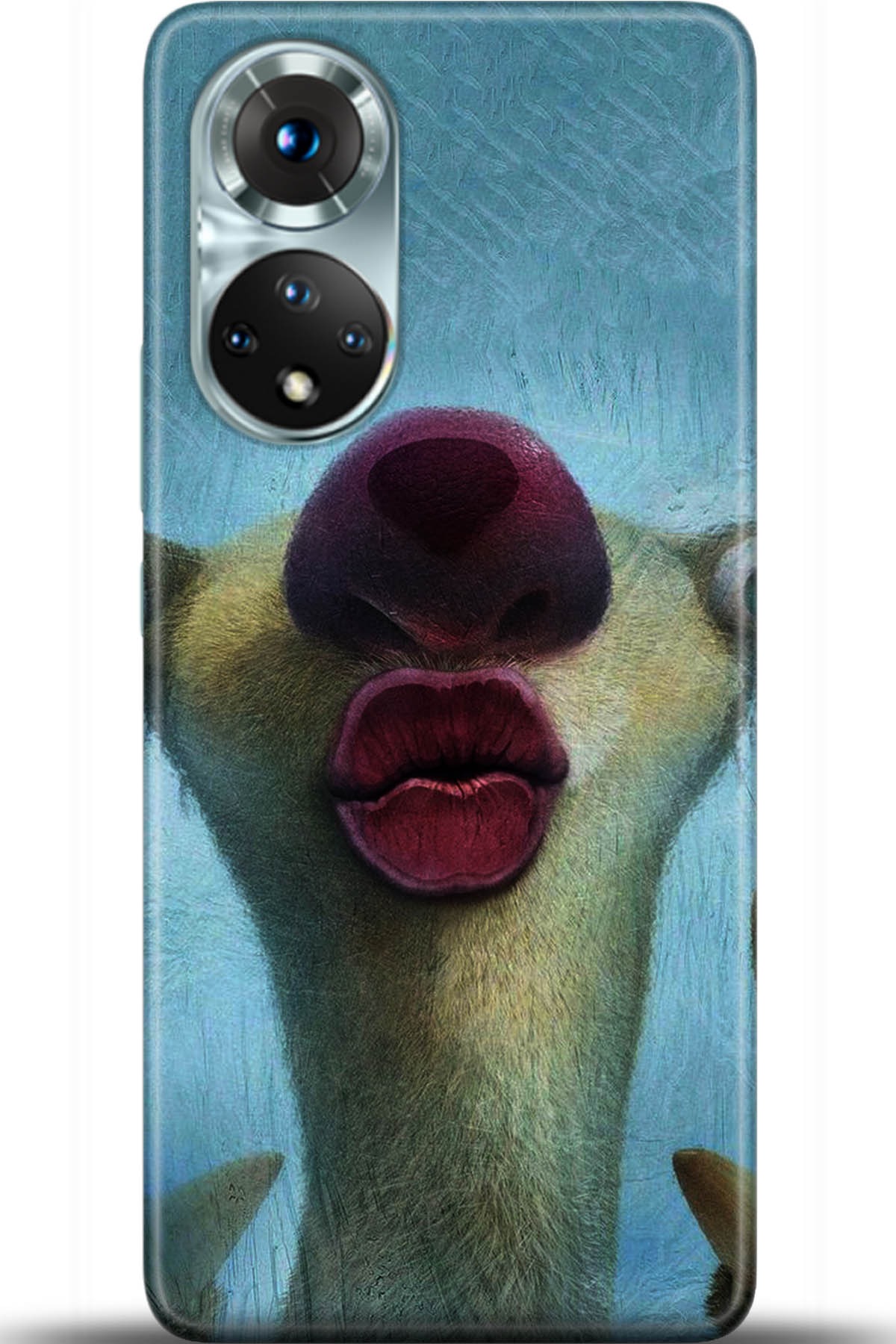 Honor 50 Kılıf HD Baskılı Kılıf - Followed Institution 5372