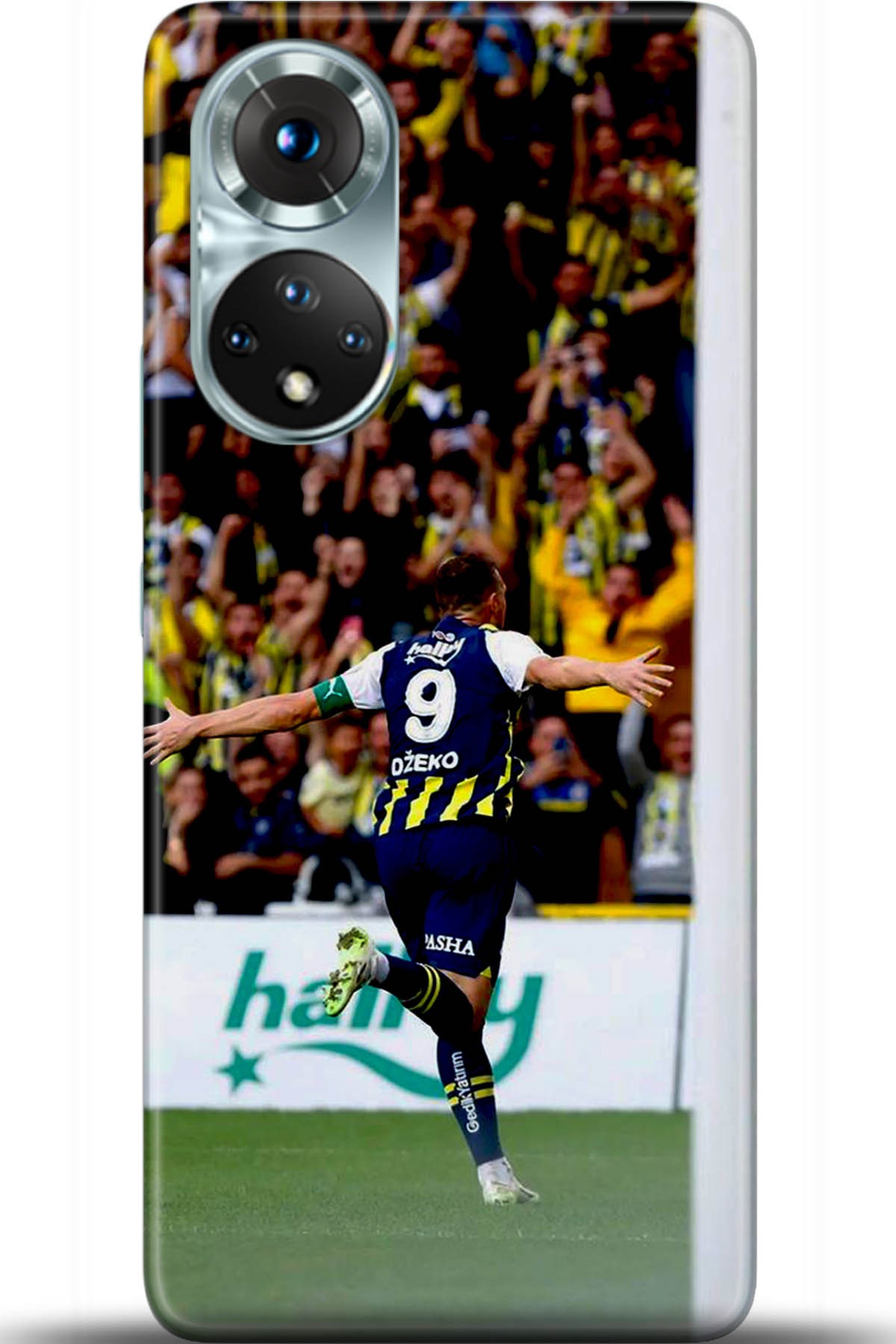 Honor 50 Kılıf HD Baskılı Kılıf - Followed Institution 5416