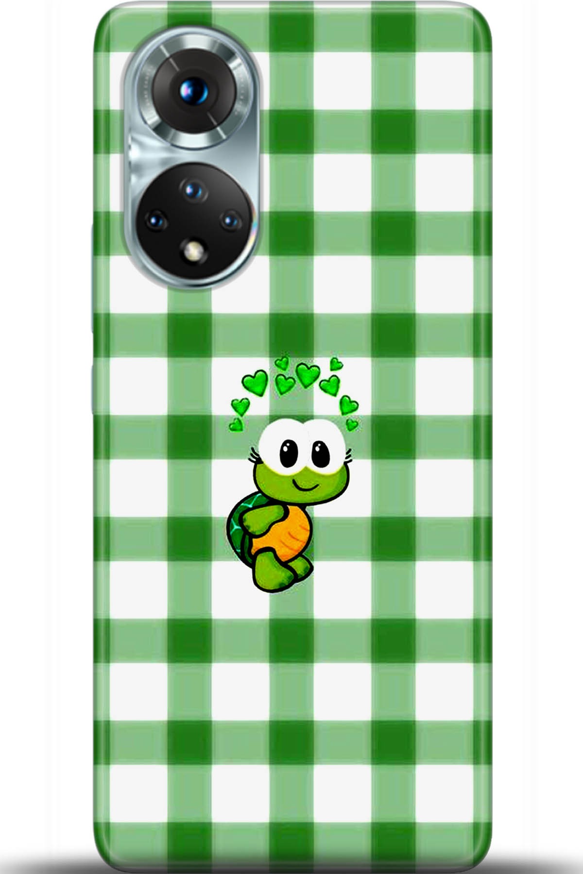 Honor 50 Kılıf HD Baskılı Kılıf - Followed Institution 5429