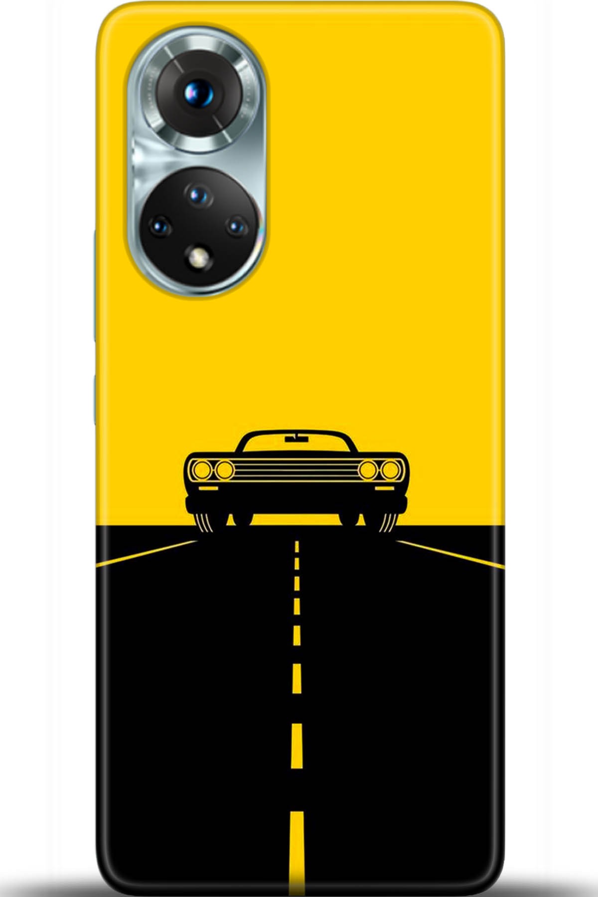 Honor 50 Kılıf HD Baskılı Kılıf - Followed Institution 5469