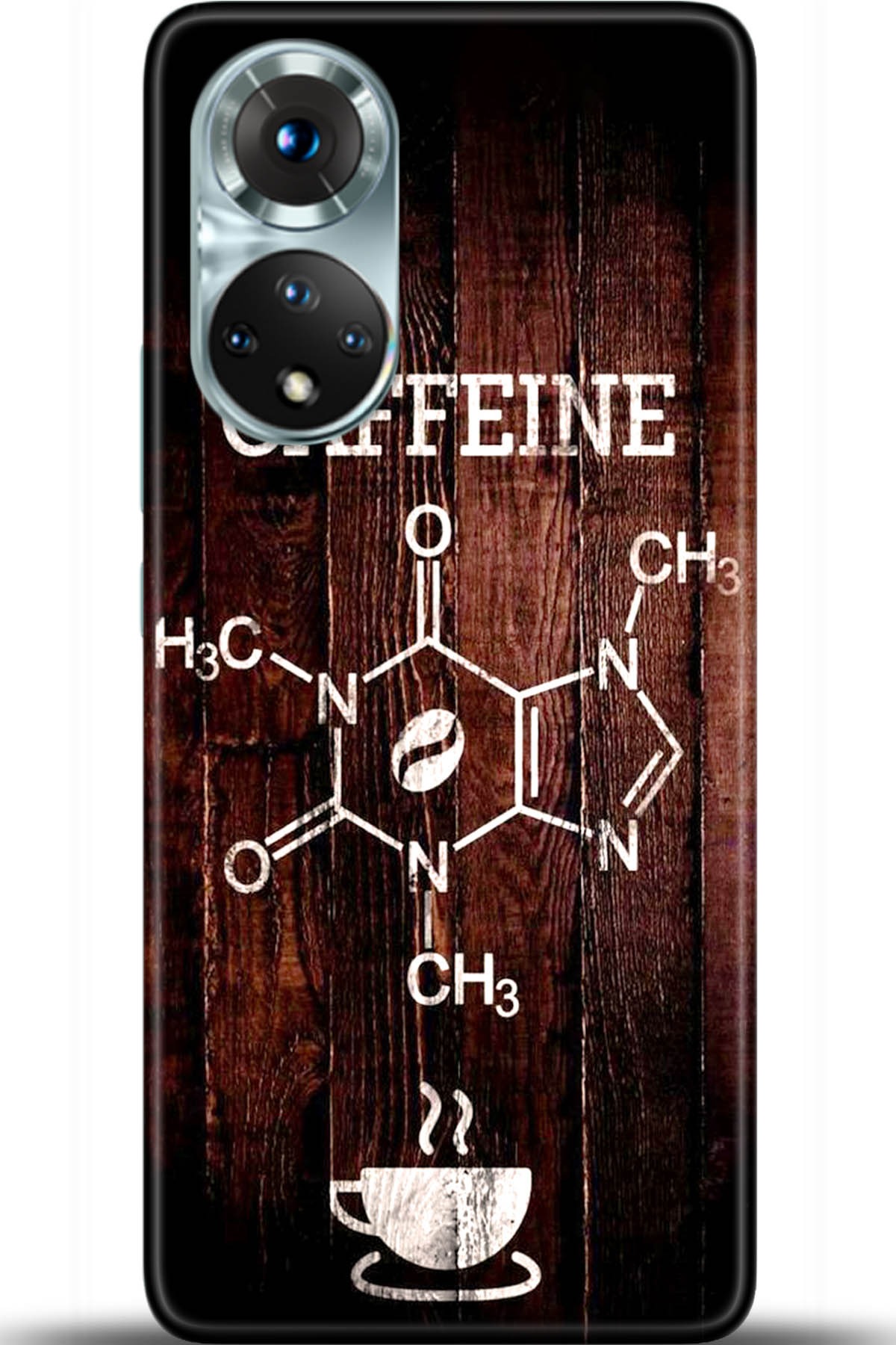 Honor 50 Kılıf HD Baskılı Kılıf - Followed Institution 5501