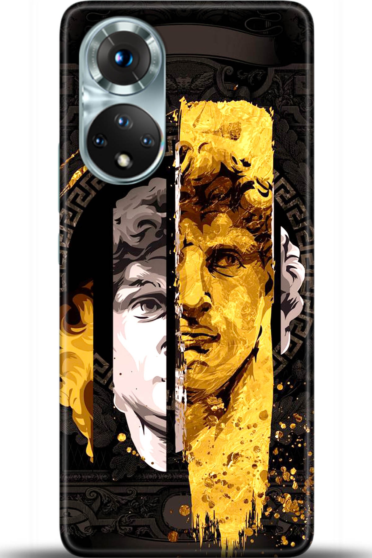 Honor 50 Kılıf HD Baskılı Kılıf - Followed Institution 5584