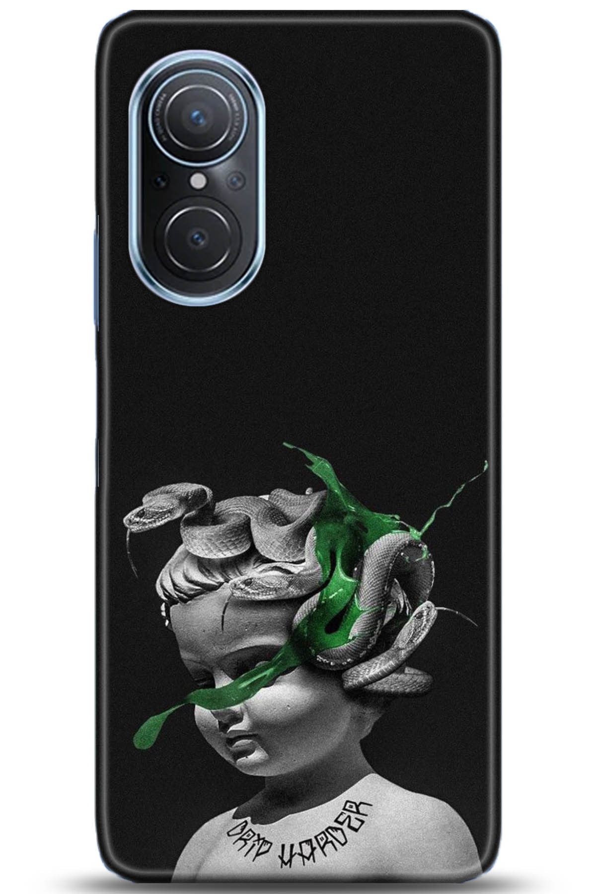 Huawei Nova 9 Uyumlu Kılıf HD Baskılı Kılıf - Followed Institution 5077