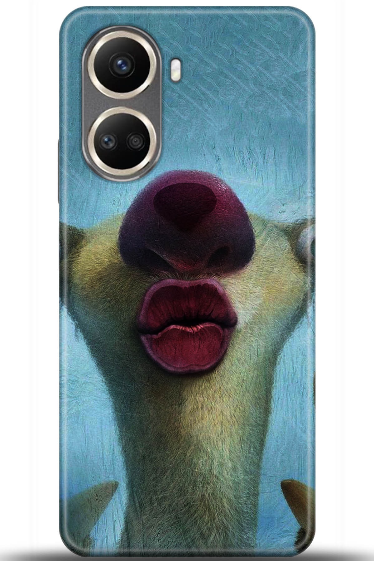 Huawei Nova 10 Uyumlu Kılıf HD Baskılı Kılıf - Followed Institution 5372