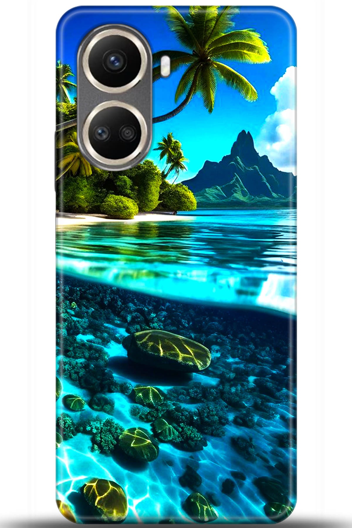 Huawei Nova 10 Uyumlu Kılıf HD Baskılı Kılıf - Followed Institution 5491