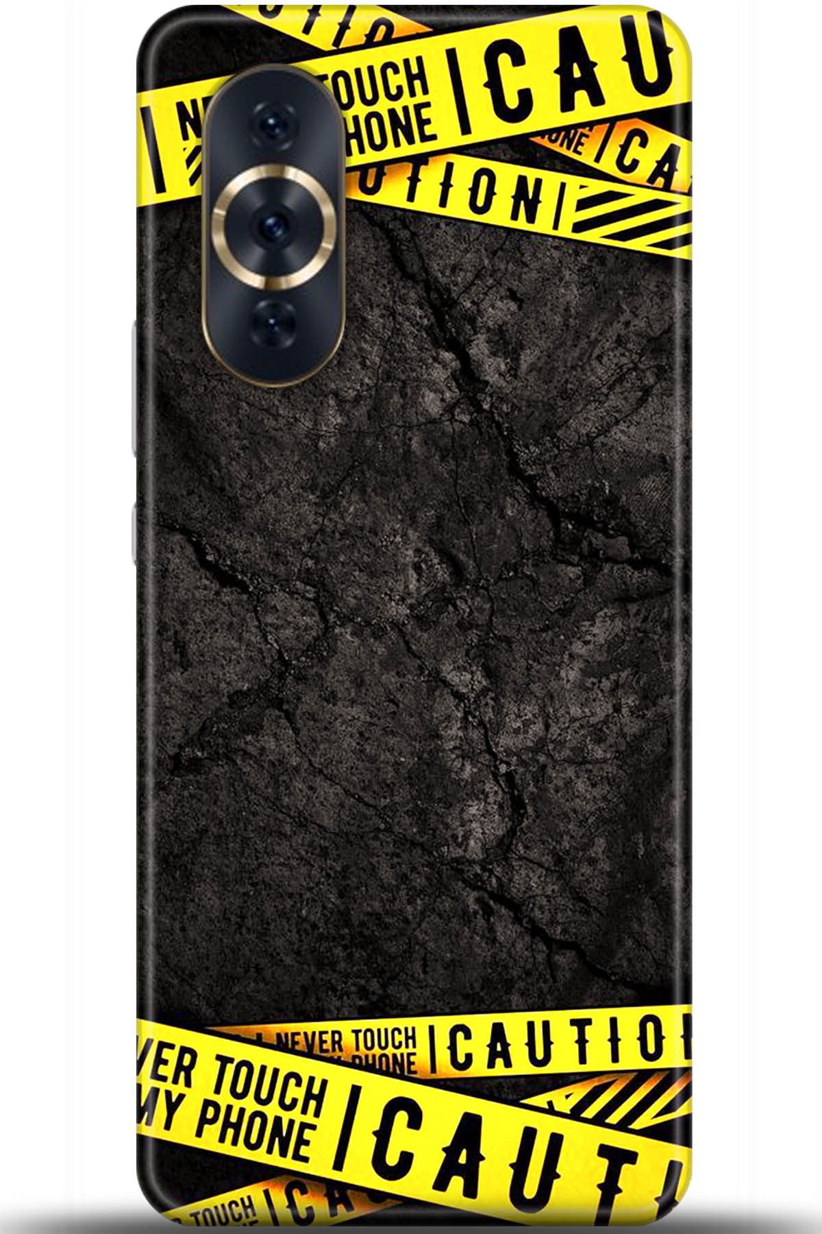 Huawei Nova 10 Pro Uyumlu Kılıf HD Baskılı Kılıf - Followed Institution 5514