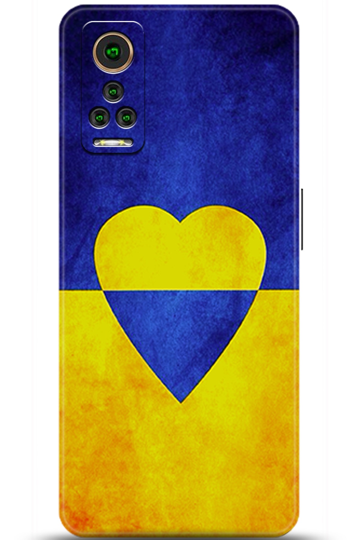 General Mobile GM 22 Pro Uyumlu Kılıf HD Baskılı Kılıf - Followed Institution 5581