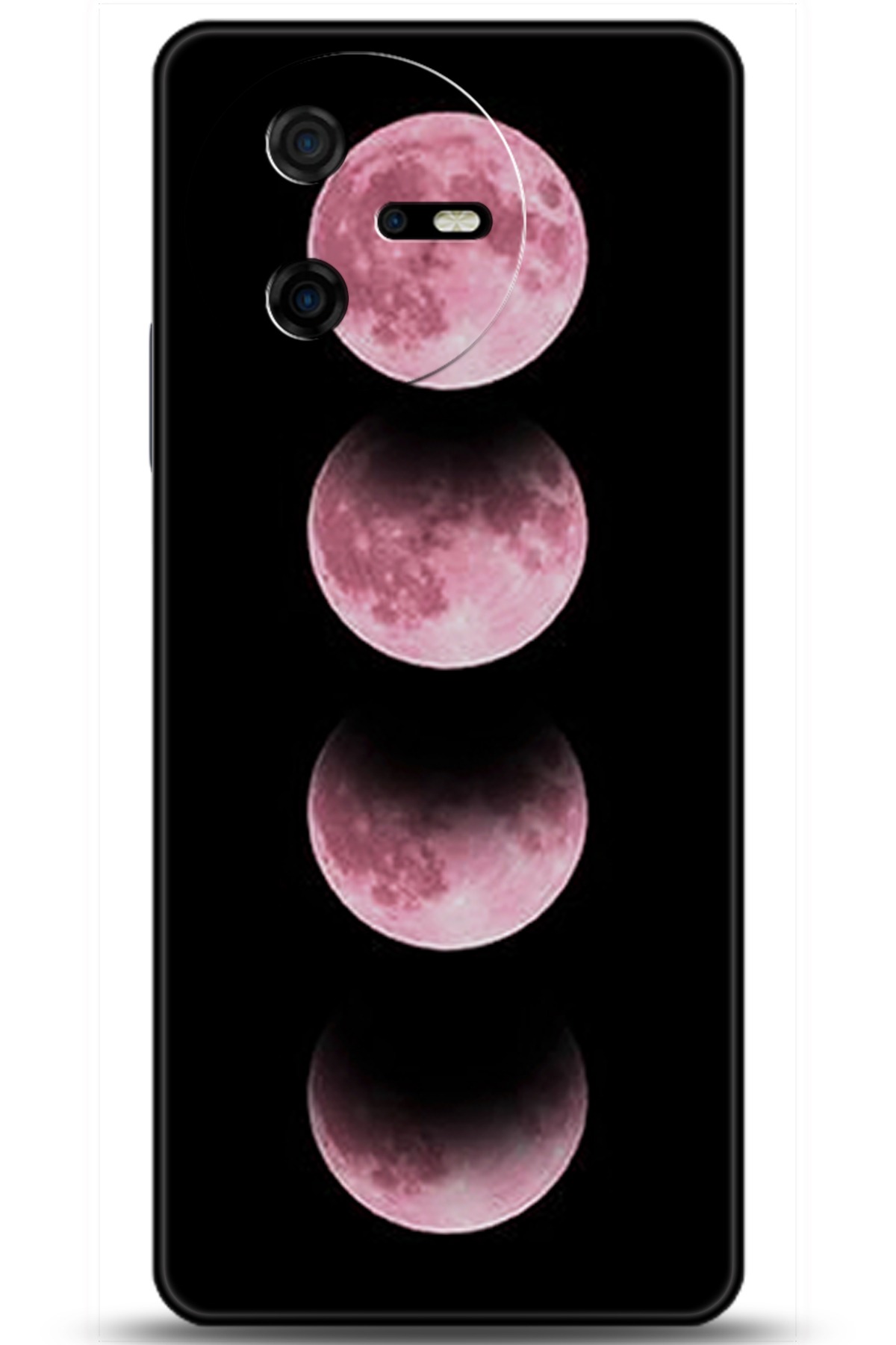 Casper Via A40 Uyumlu Kılıf HD Baskılı Kılıf - Followed Institution 5915