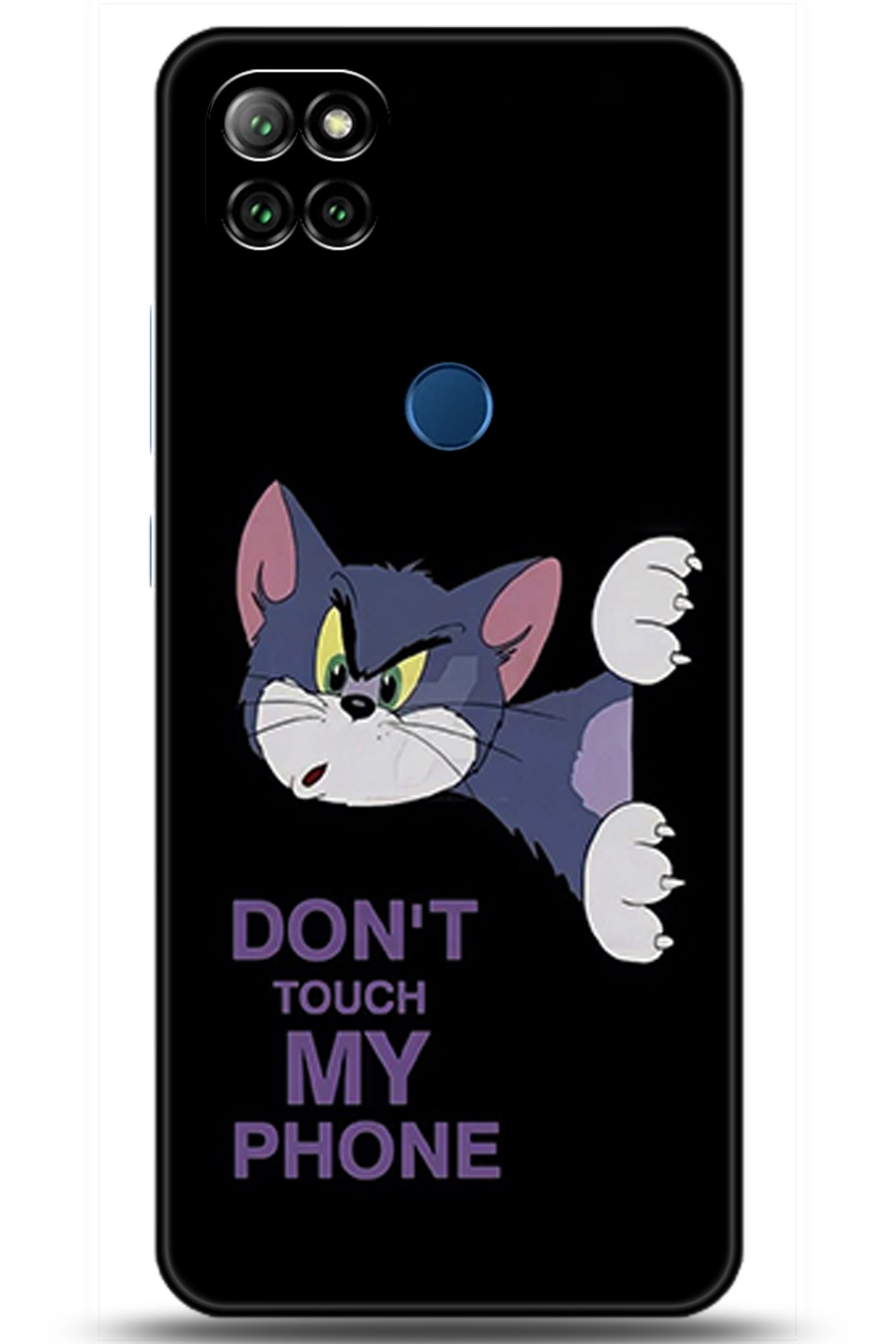 Casper Via E30 Uyumlu Kılıf HD Baskılı Kılıf - Followed Institution 5755