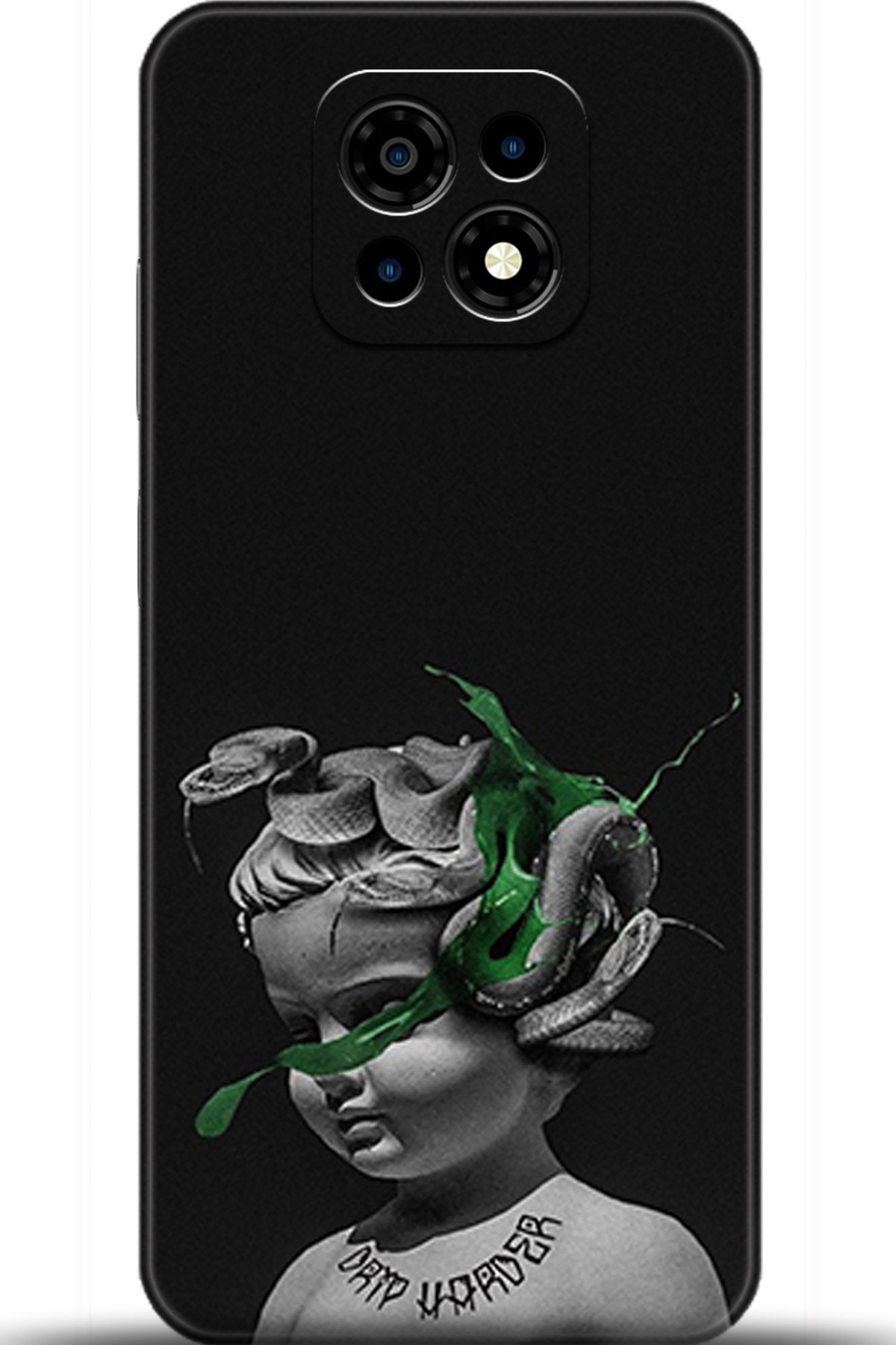 Casper Via M30 Uyumlu Kılıf HD Baskılı Kılıf - Followed Institution 5077