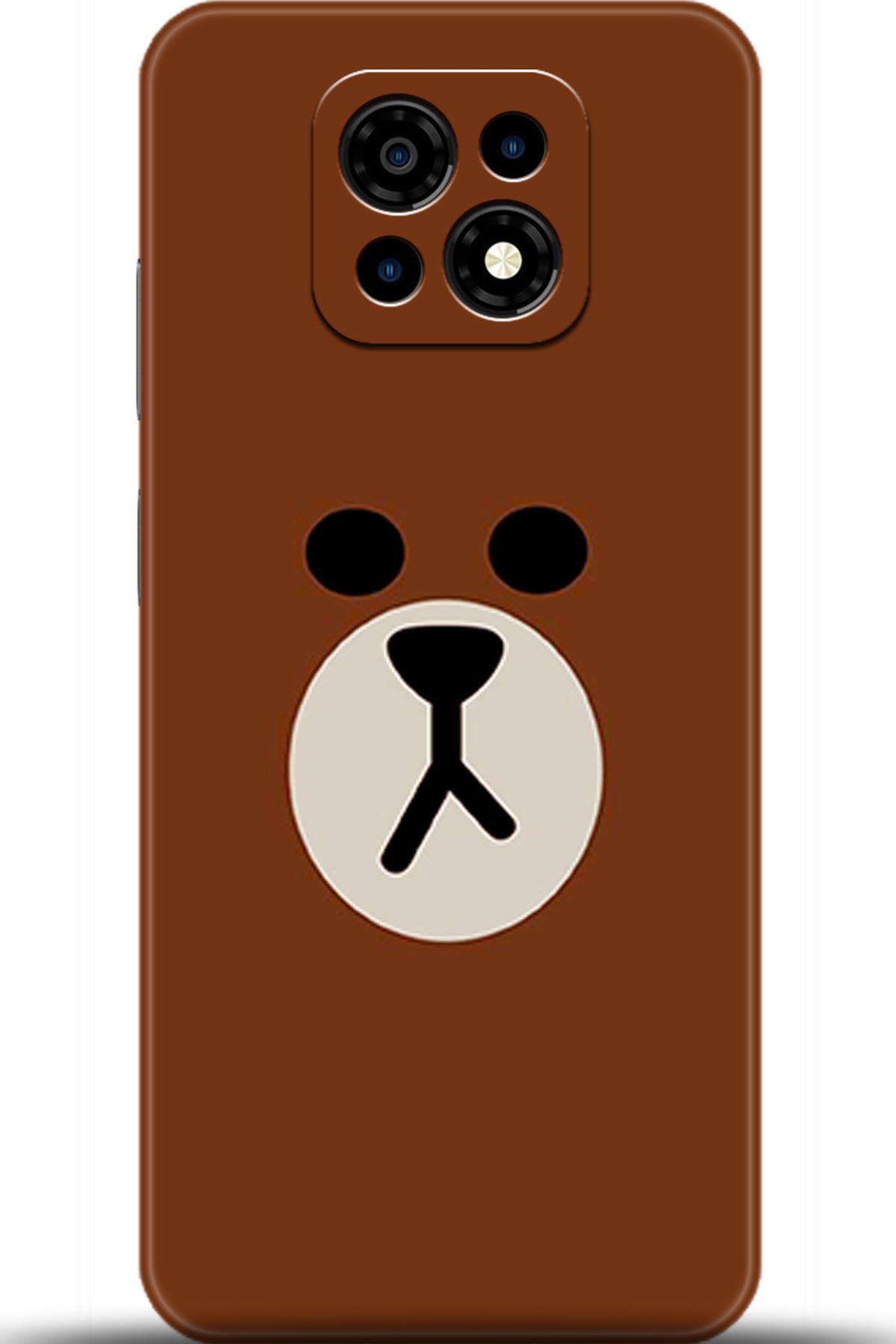 Casper Via M30 Uyumlu Kılıf HD Baskılı Kılıf - Followed Institution 5430